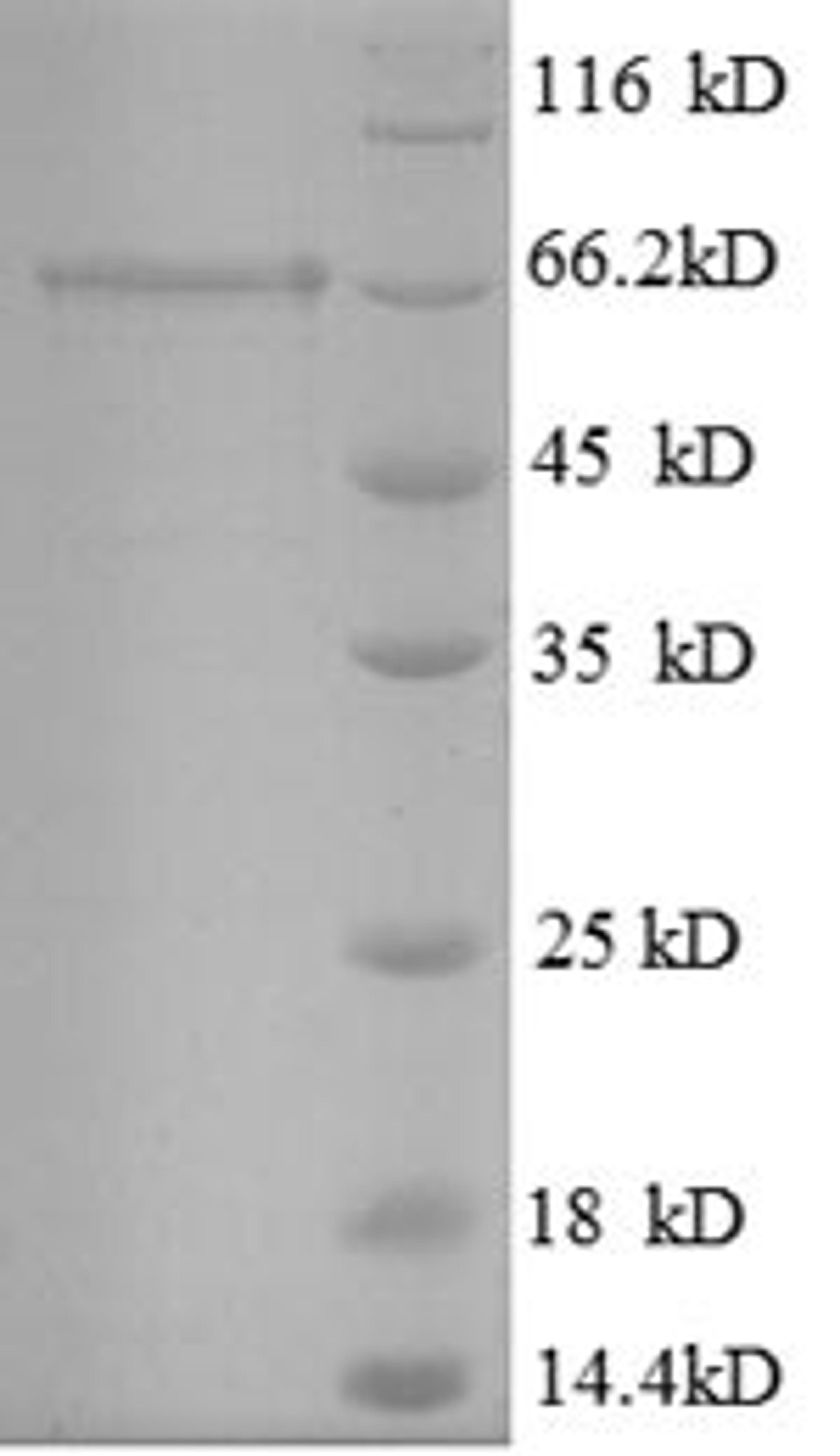 (Tris-Glycine gel) Discontinuous SDS-PAGE (reduced) with 5% enrichment gel and 15% separation gel.