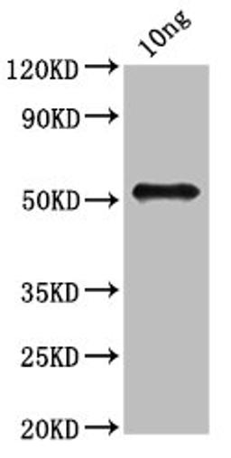 Western Blot. Positive WB detected in Recombinant protein. All lanes: fbpB antibody at 3.2ug/ml. Secondary. Goat polyclonal to rabbit IgG at 1/50000 dilution. Predicted band size: 50 kDa. Observed band size: 50 kDa. 