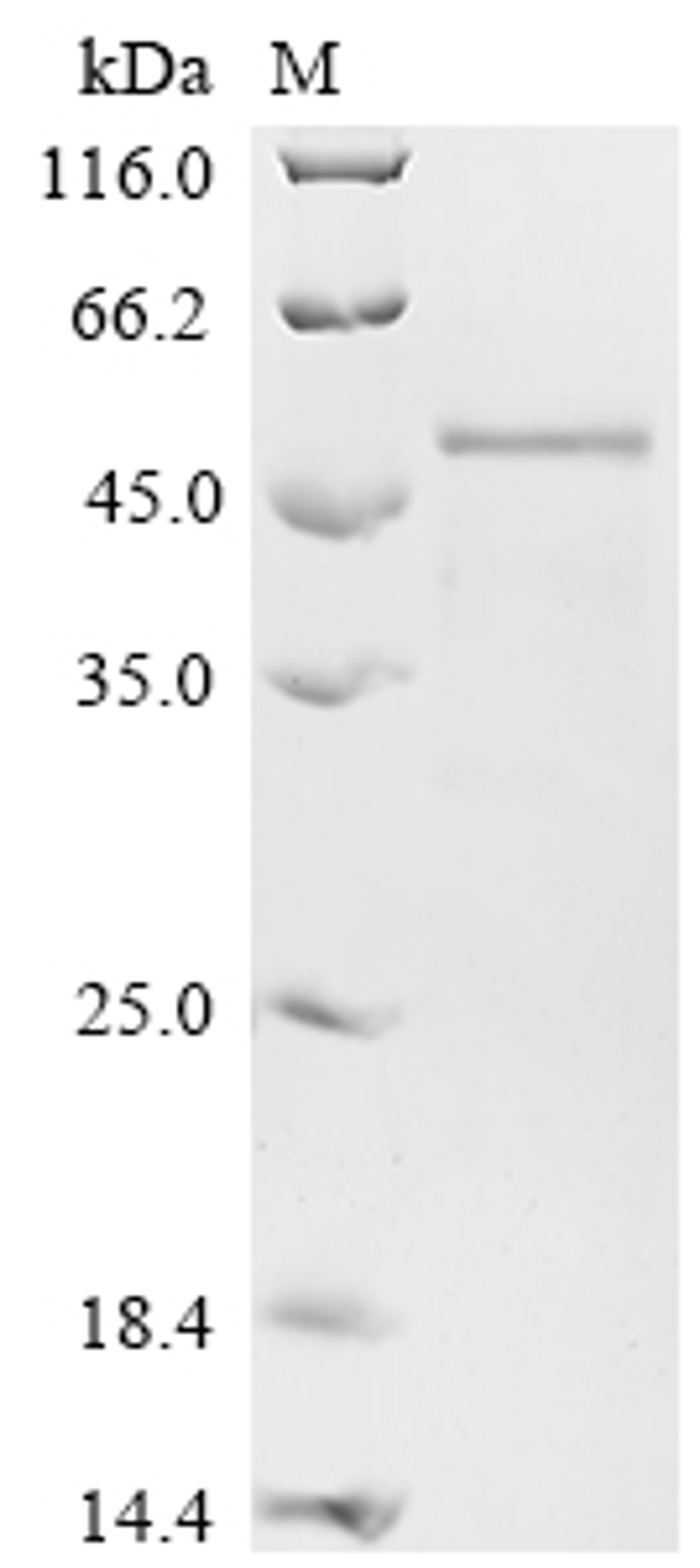 (Tris-Glycine gel) Discontinuous SDS-PAGE (reduced) with 5% enrichment gel and 15% separation gel.