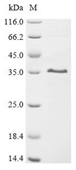 (Tris-Glycine gel) Discontinuous SDS-PAGE (reduced) with 5% enrichment gel and 15% separation gel.