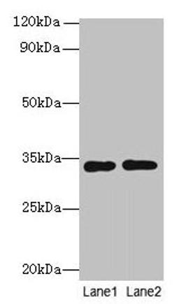 Western blot. All lanes: Rgn antibody at 8µg/ml. Lane 1: A549 whole cell lysate. Lane 2: HCT116 whole cell lysate. Secondary. Goat polyclonal to rabbit IgG at 1/10000 dilution. Predicted band size: 34 kDa. Observed band size: 34 kDa