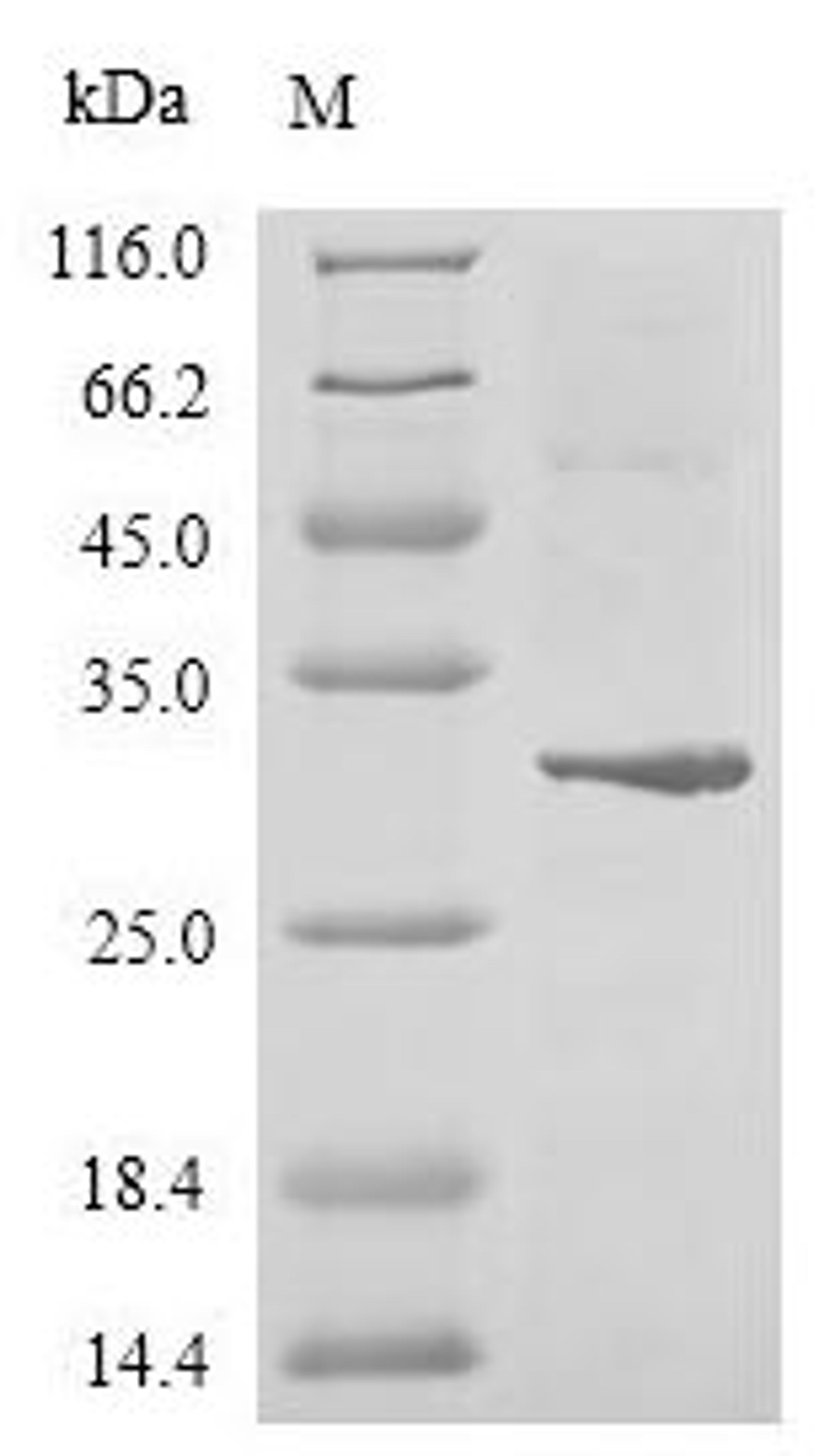 (Tris-Glycine gel) Discontinuous SDS-PAGE (reduced) with 5% enrichment gel and 15% separation gel.