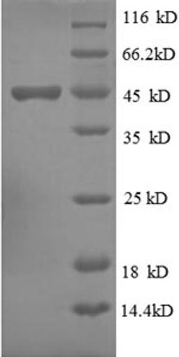(Tris-Glycine gel) Discontinuous SDS-PAGE (reduced) with 5% enrichment gel and 15% separation gel.