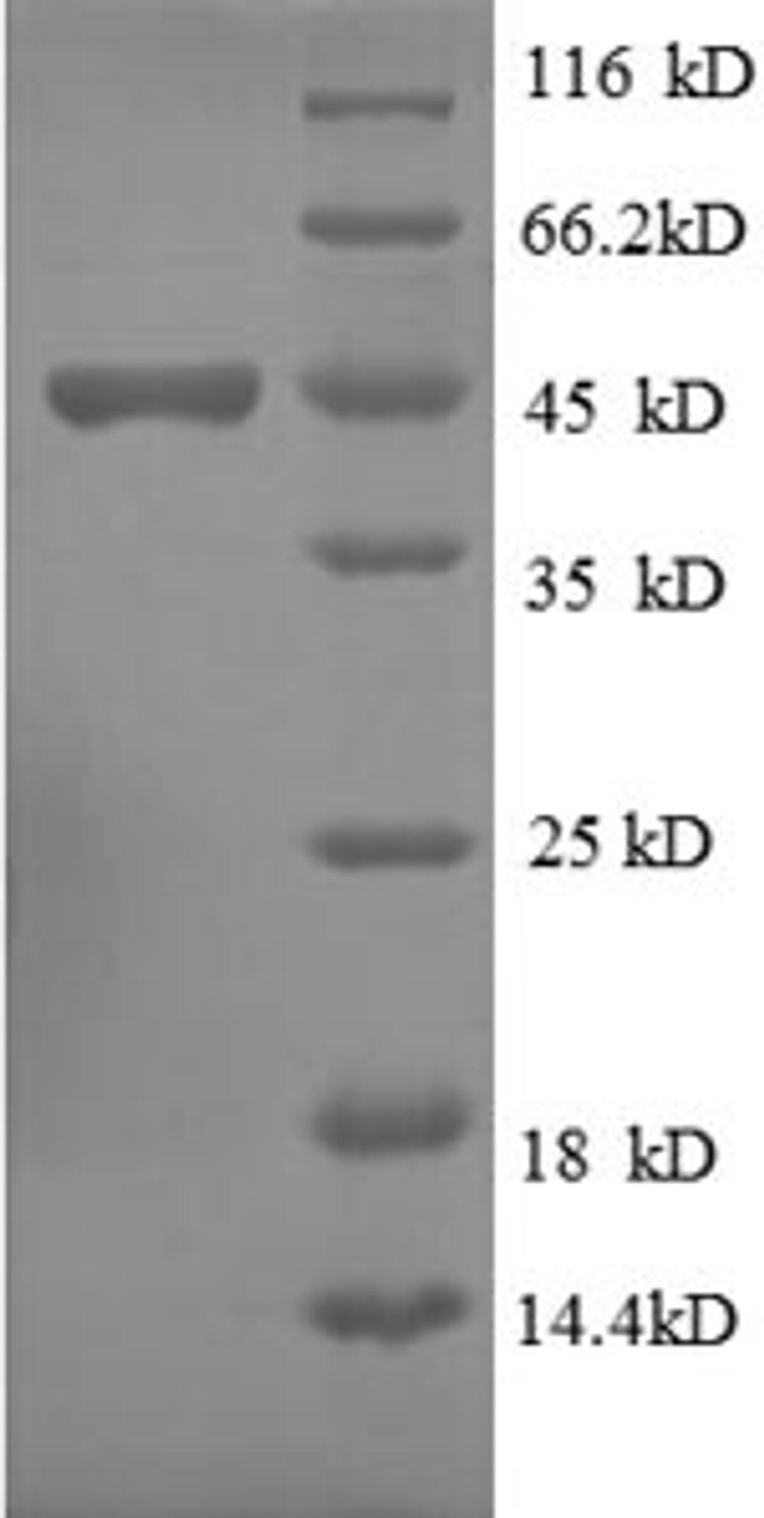 (Tris-Glycine gel) Discontinuous SDS-PAGE (reduced) with 5% enrichment gel and 15% separation gel.