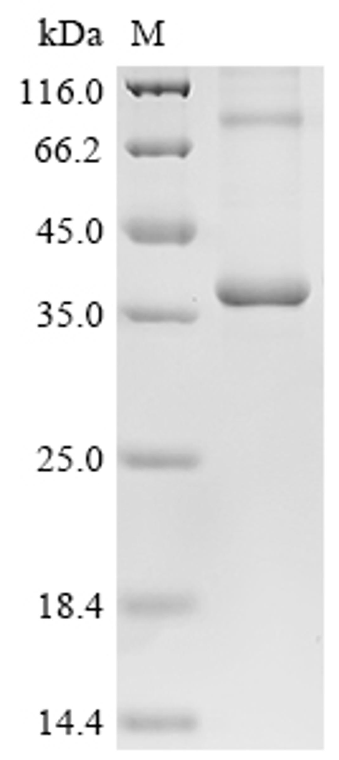 (Tris-Glycine gel) Discontinuous SDS-PAGE (reduced) with 5% enrichment gel and 15% separation gel.