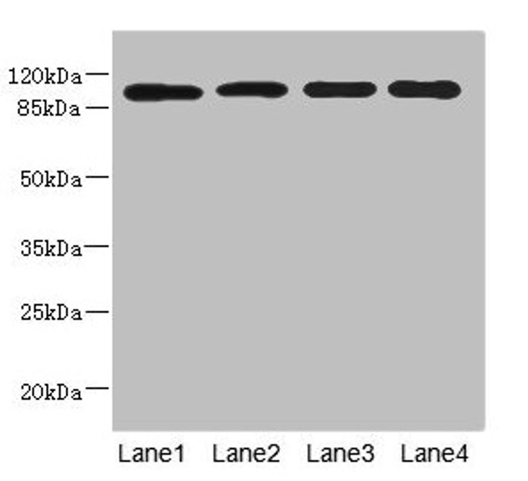 Western blot. All lanes: USP26 antibody at 5.22µg/ml. Lane 1: Hela whole cell lysate. Lane 2: U937 whole cell lysate. Lane 3: Mouse gonadal tissue. Lane 4: Mouse liver tissue. Secondary. Goat polyclonal to rabbit IgG at 1/10000 dilution. Predicted band size: 105 kDa. Observed band size: 105 kDa