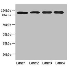 Western blot. All lanes: USP26 antibody at 5.22µg/ml. Lane 1: Hela whole cell lysate. Lane 2: U937 whole cell lysate. Lane 3: Mouse gonadal tissue. Lane 4: Mouse liver tissue. Secondary. Goat polyclonal to rabbit IgG at 1/10000 dilution. Predicted band size: 105 kDa. Observed band size: 105 kDa