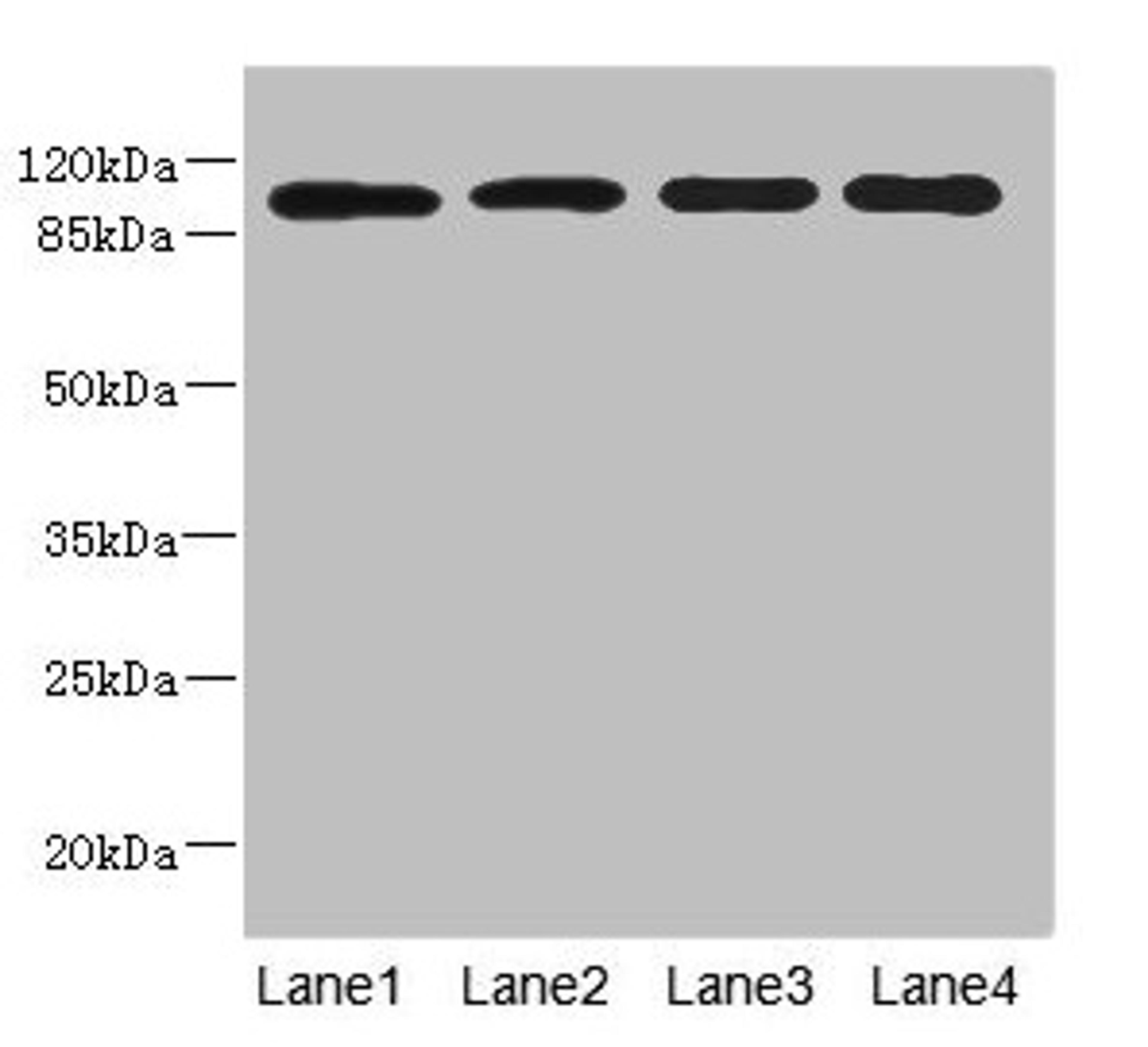 Western blot. All lanes: USP26 antibody at 5.22µg/ml. Lane 1: Hela whole cell lysate. Lane 2: U937 whole cell lysate. Lane 3: Mouse gonadal tissue. Lane 4: Mouse liver tissue. Secondary. Goat polyclonal to rabbit IgG at 1/10000 dilution. Predicted band size: 105 kDa. Observed band size: 105 kDa