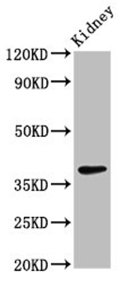 Western Blot. Positive WB detected in: Rat kidney tissue. All lanes: LIMS1 antibody at 2.7ug/ml. Secondary. Goat polyclonal to rabbit IgG at 1/50000 dilution. Predicted band size: 38, 39, 45, 42 kDa. Observed band size: 38 kDa. 