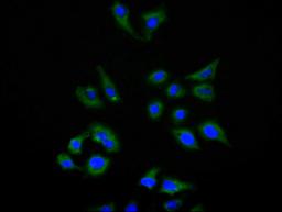 Immunofluorescence staining of Hela cell with CSB-RA010145MA1HU at 1:150, counter-stained with DAPI. The cells were fixed in 4% formaldehyde and blocked in 10% normal Goat Serum. The cells were then incubated with the antibody overnight at 4C. The secondary antibody was FITC-conjugated AffiniPure Goat Anti-Human IgG(H+L).