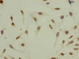 Immunocytochemistry analysis of Hela cells using CSB-PA010429OA08acHU at dilution of 1:100