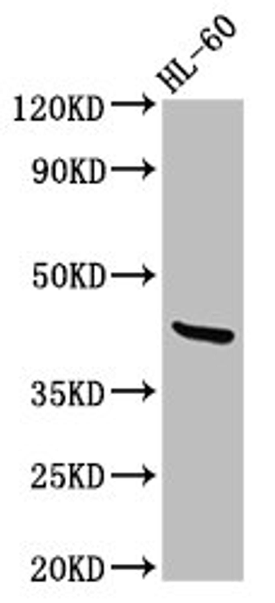 Western Blot. Positive WB detected in: HL60 whole cell lysate. All lanes: CERS6 antibody at 2.7ug/ml. Secondary. Goat polyclonal to rabbit IgG at 1/50000 dilution. Predicted band size: 45, 46 kDa. Observed band size: 45 kDa. 