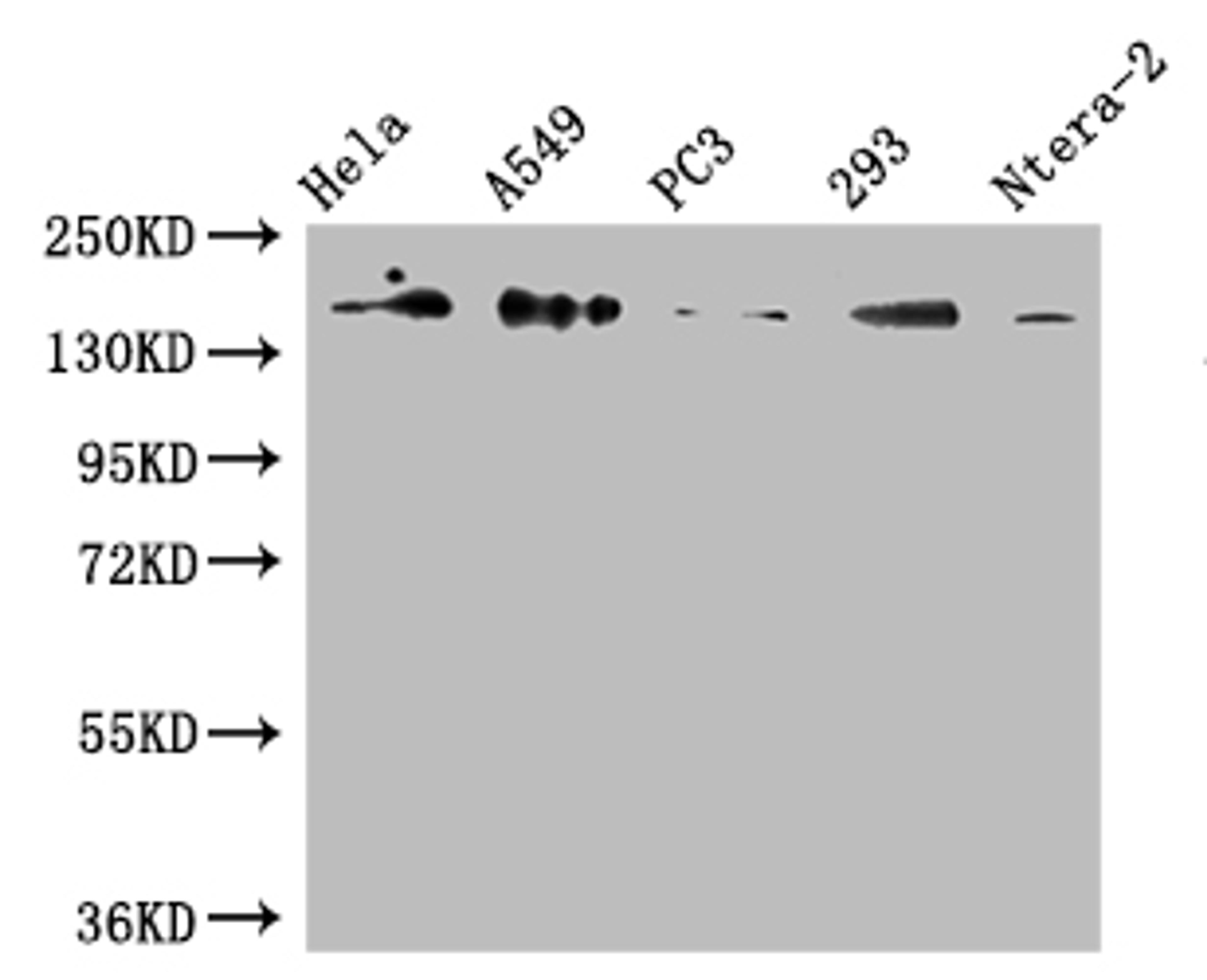Western Blot. Positive WB detected in: Hela whole cell lysate, A549 whole cell lysate, PC3 whole cell lysate, 293 whole cell lysate, Ntera-2 whole cell lysate. All lanes: DUOX2 antibody at 1:500. Secondary. Goat polyclonal to rabbit IgG at 1/50000 dilution. Predicted band size: 176 kDa. Observed band size: 176 kDa.