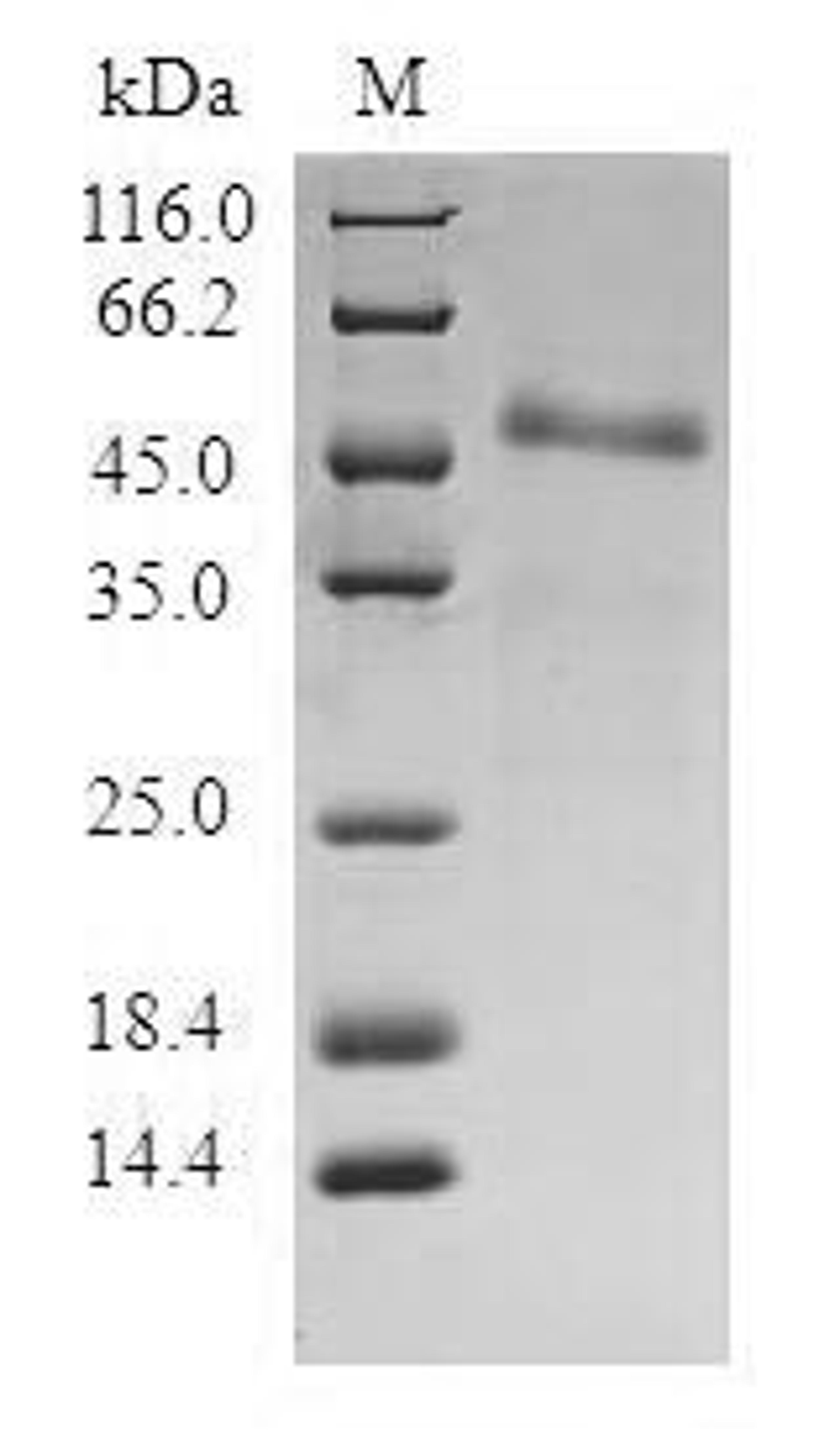 (Tris-Glycine gel) Discontinuous SDS-PAGE (reduced) with 5% enrichment gel and 15% separation gel.