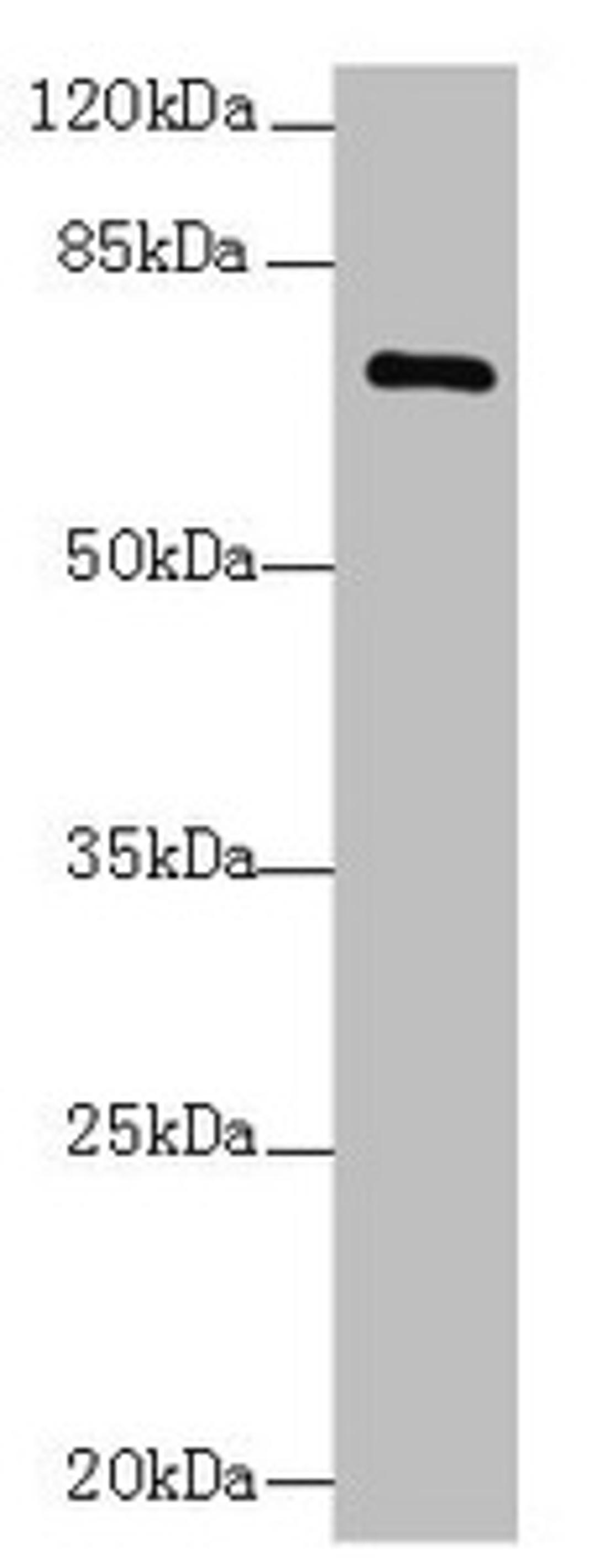 Western blot. All lanes: COLGALT2 antibody at 0.5µg/ml + NIH/3T3 whole cell lysate. Secondary. Goat polyclonal to rabbit IgG at 1/10000 dilution. Predicted band size: 73 kDa. Observed band size: 73 kDa