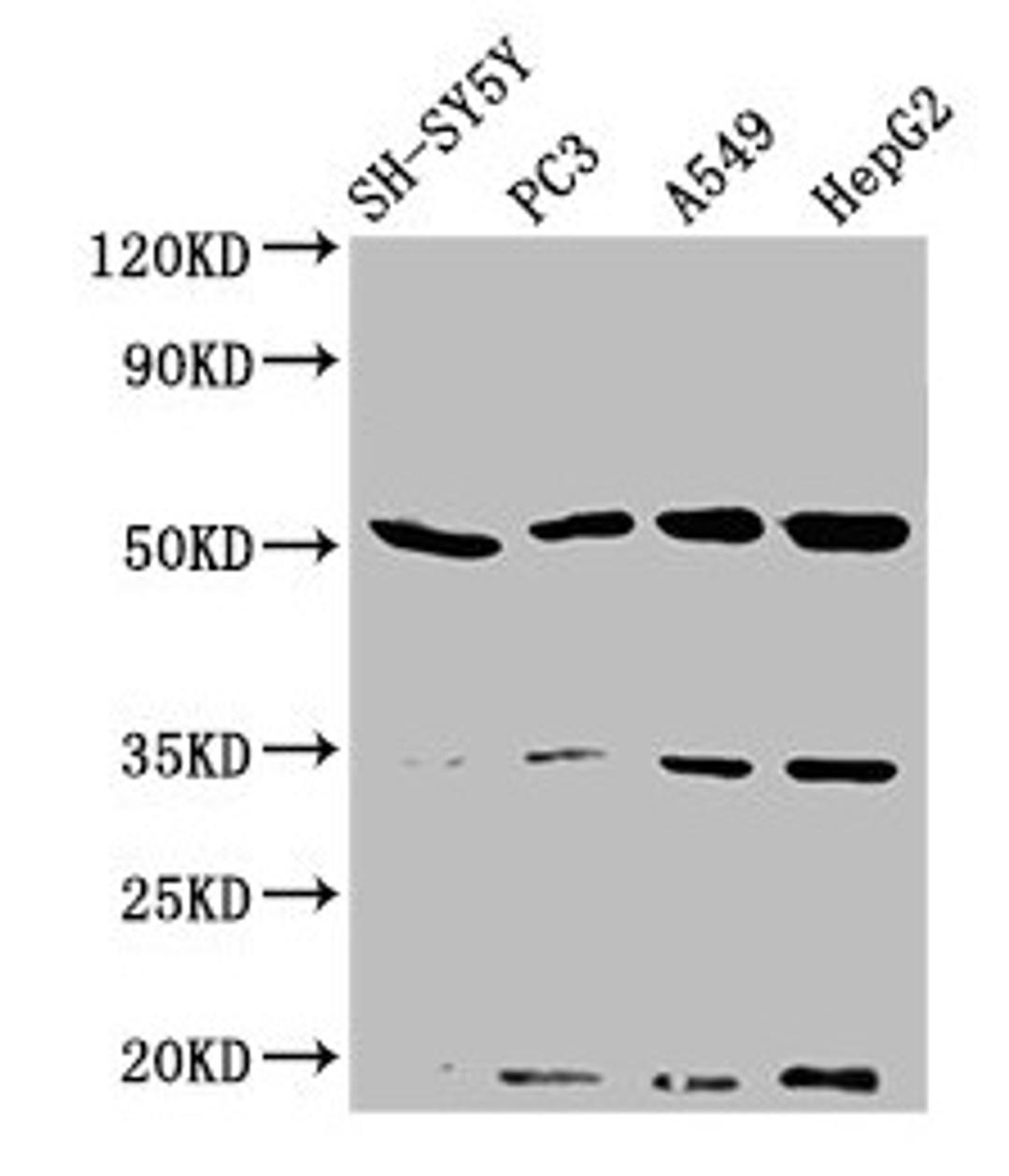 Western Blot. Positive WB detected in: SH-SY5Y whole cell lysate, PC-3 whole cell lysate, A549 whole cell lysate, HepG2 whole cell lysate. All lanes: NAGPA antibody at 3.2µg/ml. Secondary. Goat polyclonal to rabbit IgG at 1/50000 dilution. Predicted band size: 57, 53, 34 kDa. Observed band size: 53 kDa