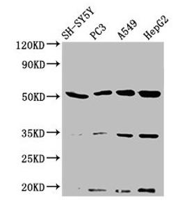 Western Blot. Positive WB detected in: SH-SY5Y whole cell lysate, PC-3 whole cell lysate, A549 whole cell lysate, HepG2 whole cell lysate. All lanes: NAGPA antibody at 3.2µg/ml. Secondary. Goat polyclonal to rabbit IgG at 1/50000 dilution. Predicted band size: 57, 53, 34 kDa. Observed band size: 53 kDa