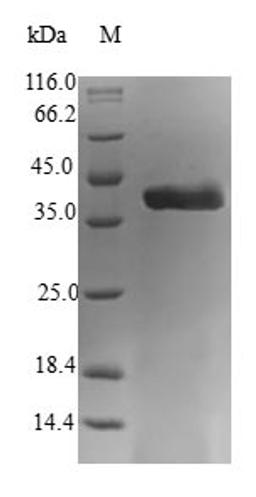 (Tris-Glycine gel) Discontinuous SDS-PAGE (reduced) with 5% enrichment gel and 15% separation gel.