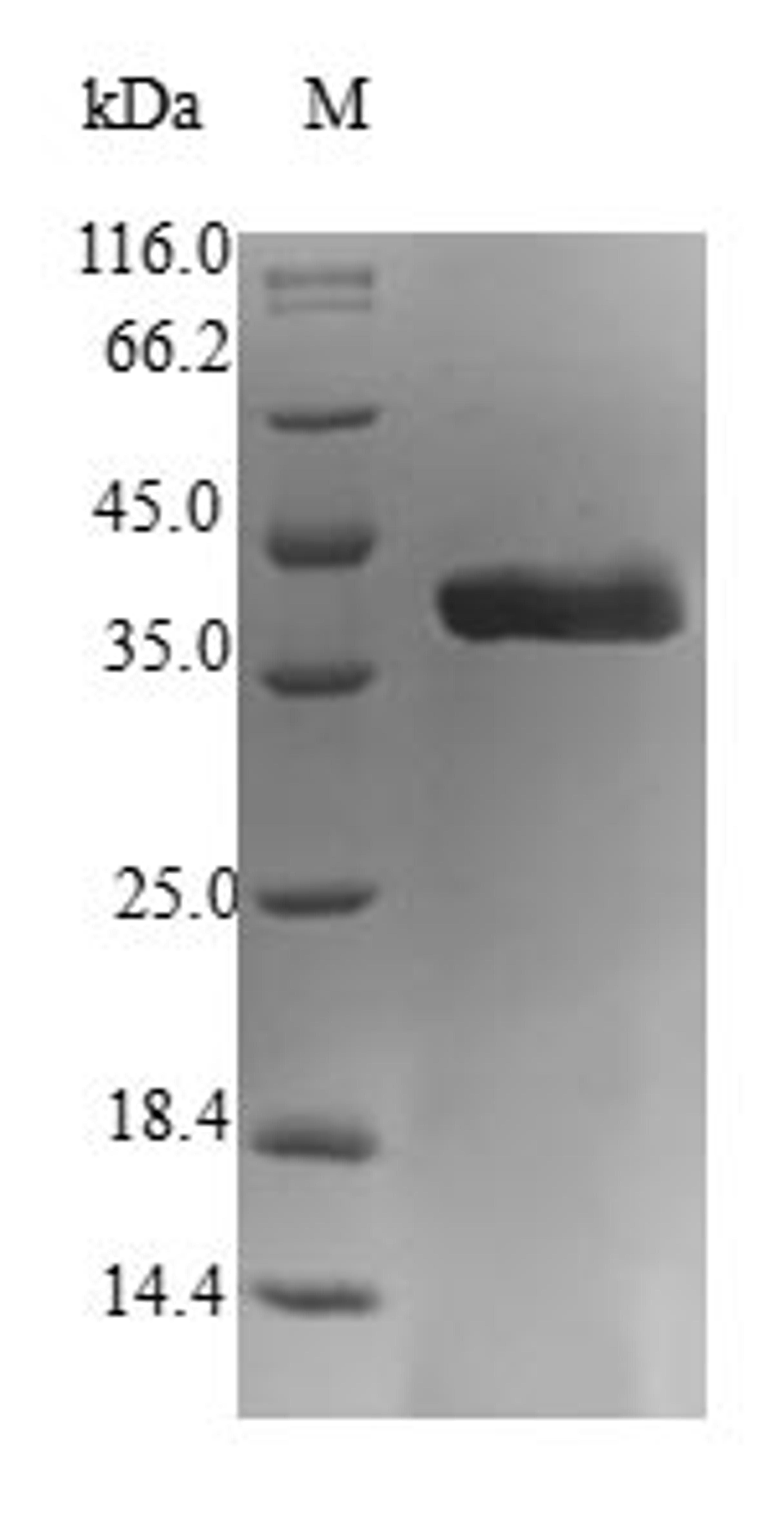 (Tris-Glycine gel) Discontinuous SDS-PAGE (reduced) with 5% enrichment gel and 15% separation gel.