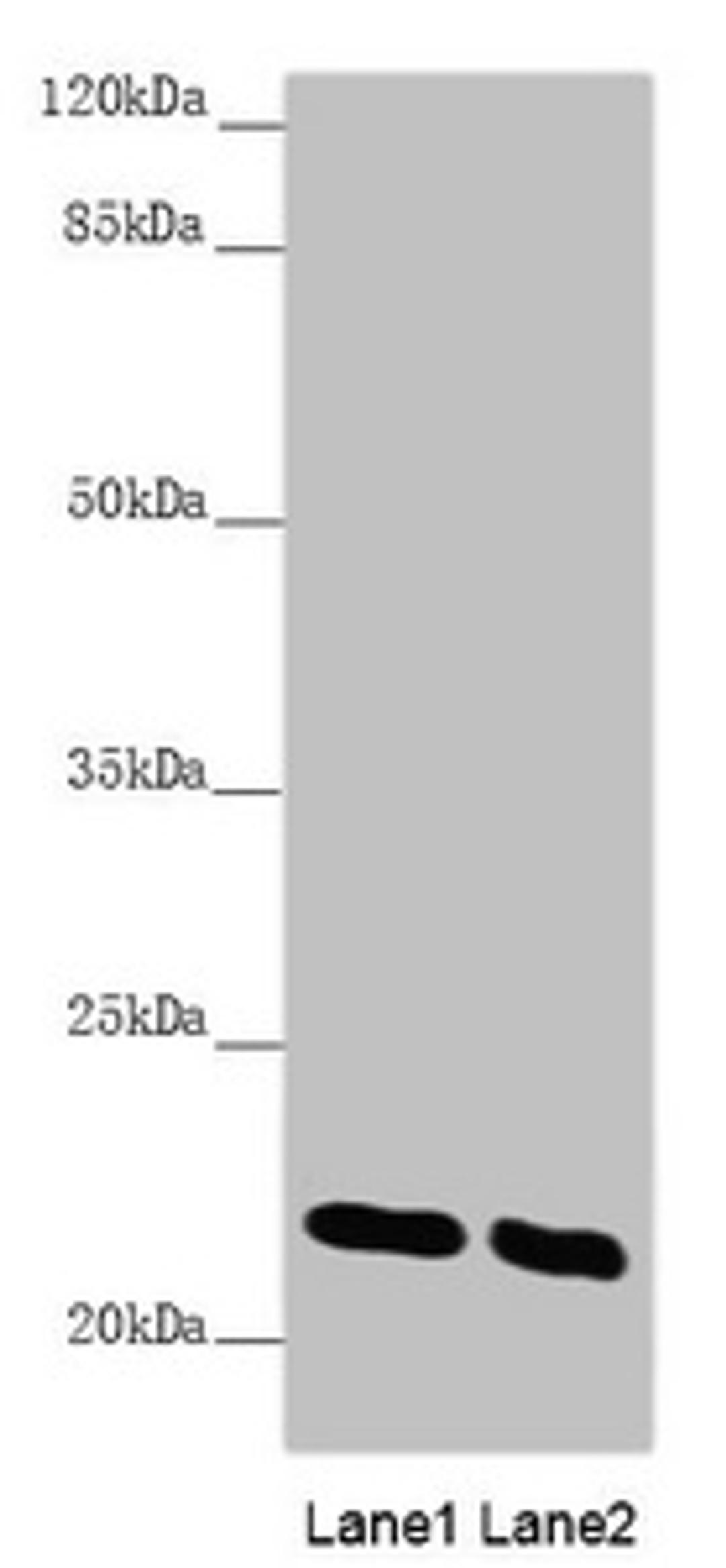 Western blot. All lanes: AK1 antibody at 0.51 ug/ml. Lane 1: Mouse skeletal muscle tissue. Lane 2: Mouse heart tissue. Secondary. Goat polyclonal to rabbit IgG at 1/10000 dilution. Predicted band size: 22 kDa. Observed band size: 22 kDa. 