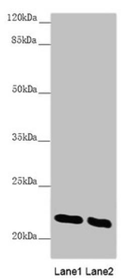 Western blot. All lanes: AK1 antibody at 0.51 ug/ml. Lane 1: Mouse skeletal muscle tissue. Lane 2: Mouse heart tissue. Secondary. Goat polyclonal to rabbit IgG at 1/10000 dilution. Predicted band size: 22 kDa. Observed band size: 22 kDa. 
