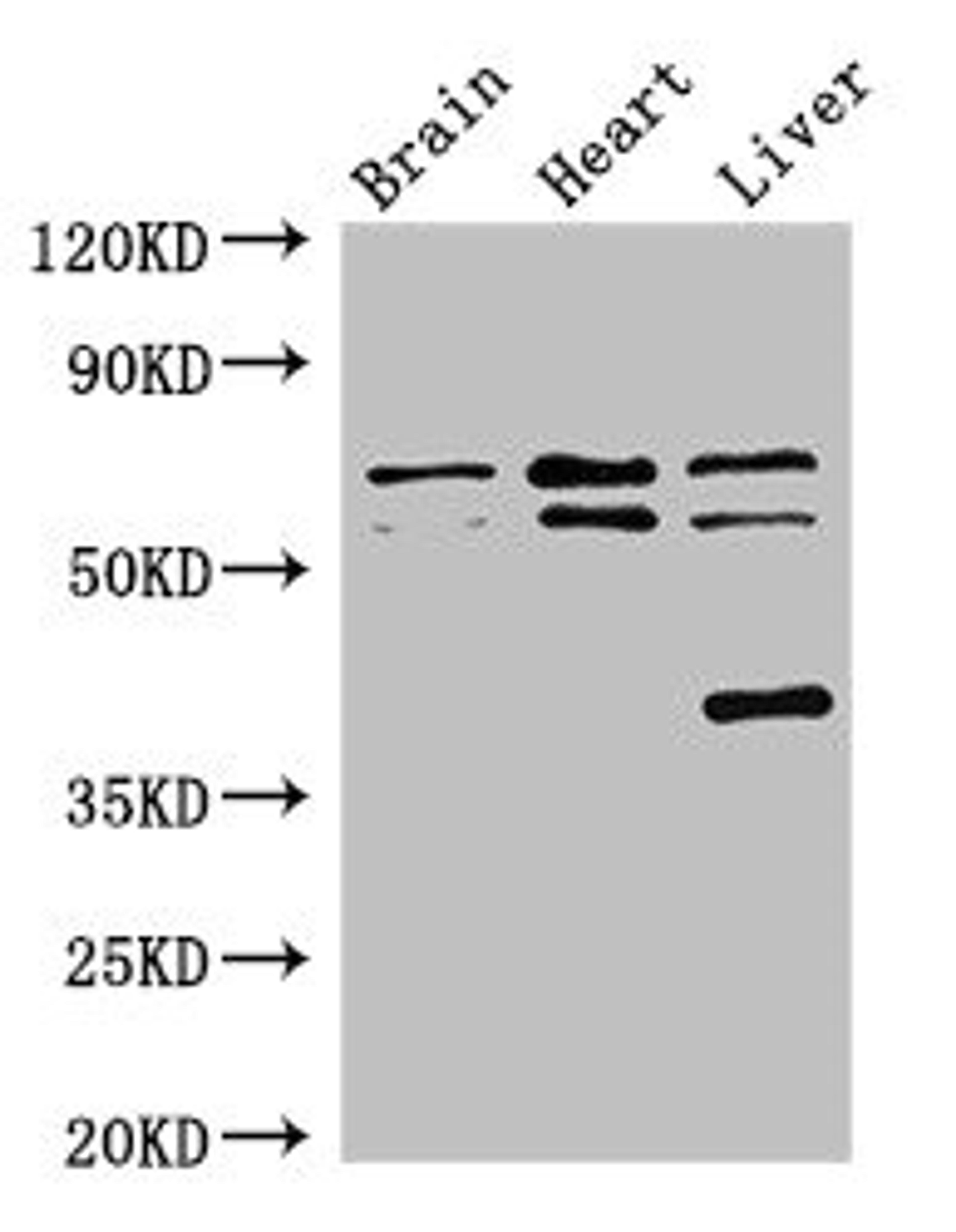 Western Blot. Positive WB detected in: Mouse brain tissue, Rat heart tissue, Rat liver tissue. All lanes: TRAF3IP3 antibody at 2.7ug/ml. Secondary. Goat polyclonal to rabbit IgG at 1/50000 dilution. Predicted band size: 64, 62, 41 kDa. Observed band size: 64, 62, 41 kDa. 