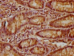 IHC image of CSB-PA010418PA64nacHU diluted at 1:15 and staining in paraffin-embedded human small intestine tissue performed on a Leica BondTM system. After dewaxing and hydration, antigen retrieval was mediated by high pressure in a citrate buffer (pH 6.0). Section was blocked with 10% normal goat serum 30min at RT. Then primary antibody (1% BSA) was incubated at 4°C overnight. The primary is detected by a biotinylated secondary antibody and visualized using an HRP conjugated SP system.