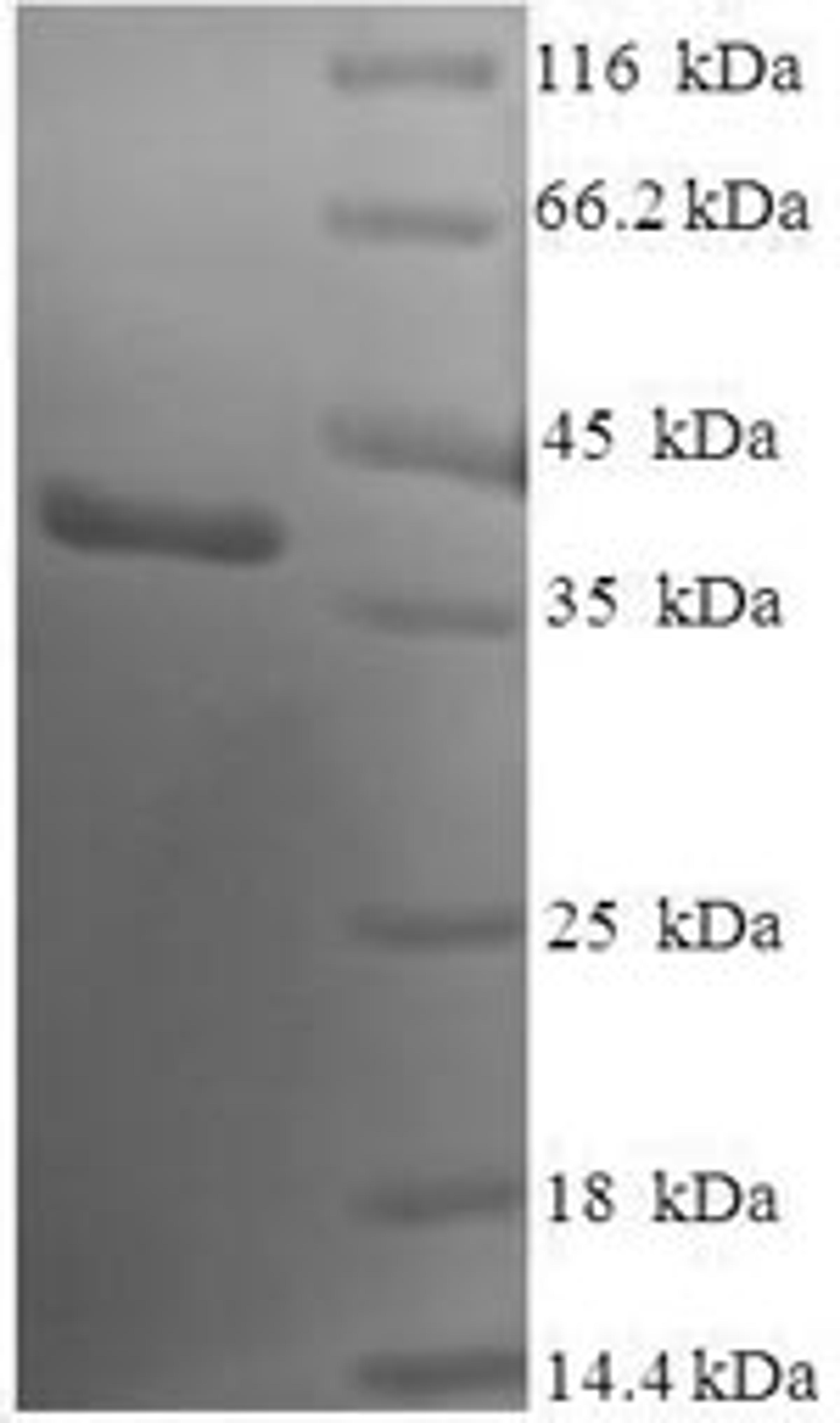 (Tris-Glycine gel) Discontinuous SDS-PAGE (reduced) with 5% enrichment gel and 15% separation gel.