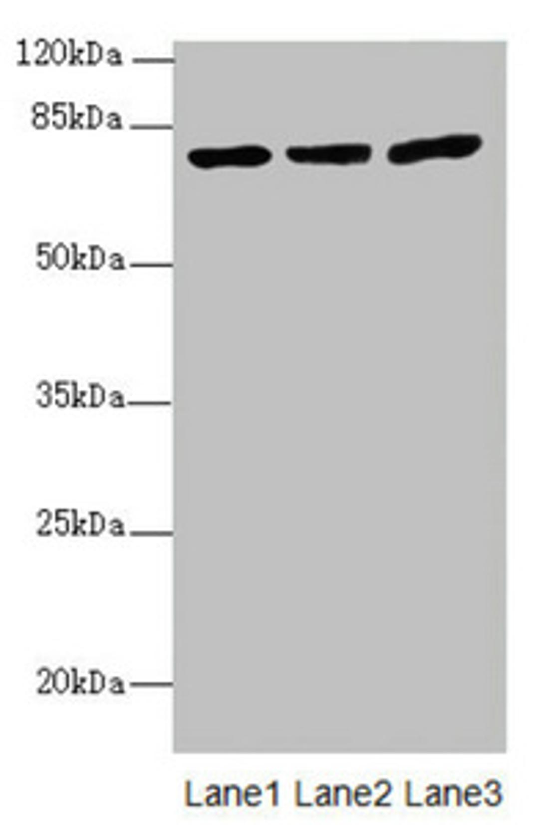 Western blot. All lanes: KBTBD7 antibody at 1.85ug/ml. Lane 1: HL60 whole cell lysate. Lane 2: A549 whole cell lysate. Lane 3: 293T whole cell lysate. Secondary. Goat polyclonal to rabbit IgG at 1/10000 dilution. Predicted band size: 77 kDa. Observed band size: 77 kDa. 