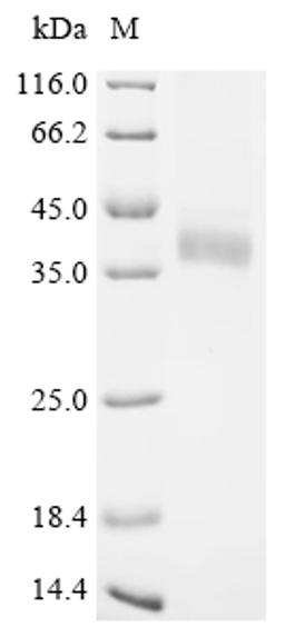 (Tris-Glycine gel) Discontinuous SDS-PAGE (reduced) with 5% enrichment gel and 15% separation gel.