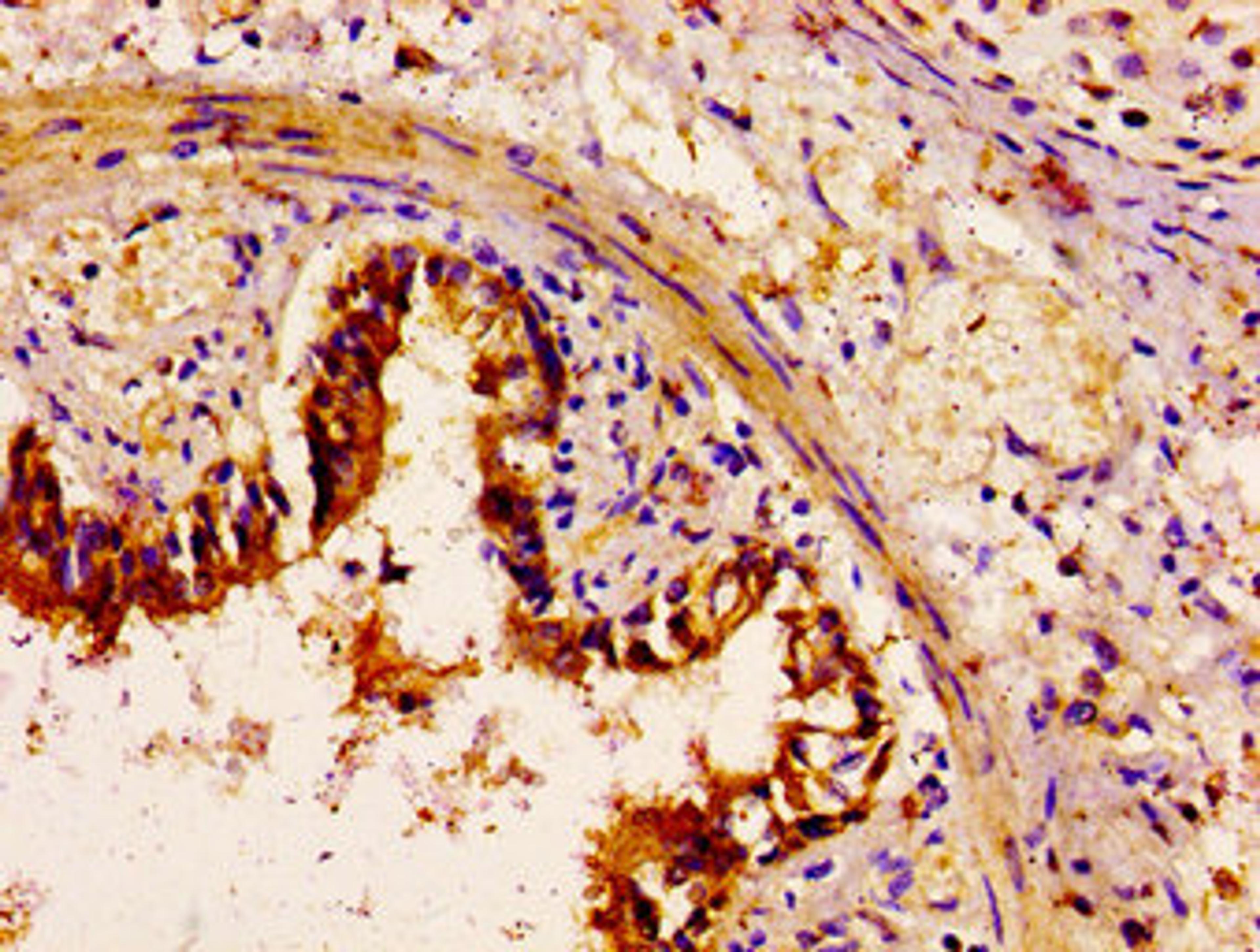IHC image of CSB-PA773786LA01HU diluted at 1:100 and staining in paraffin-embedded human lung tissue performed on a Leica BondTM system. After dewaxing and hydration, antigen retrieval was mediated by high pressure in a citrate buffer (pH 6.0). Section was blocked with 10% normal goat serum 30min at RT. Then primary antibody (1% BSA) was incubated at 4&deg;C overnight. The primary is detected by a biotinylated secondary antibody and visualized using an HRP conjugated SP system.