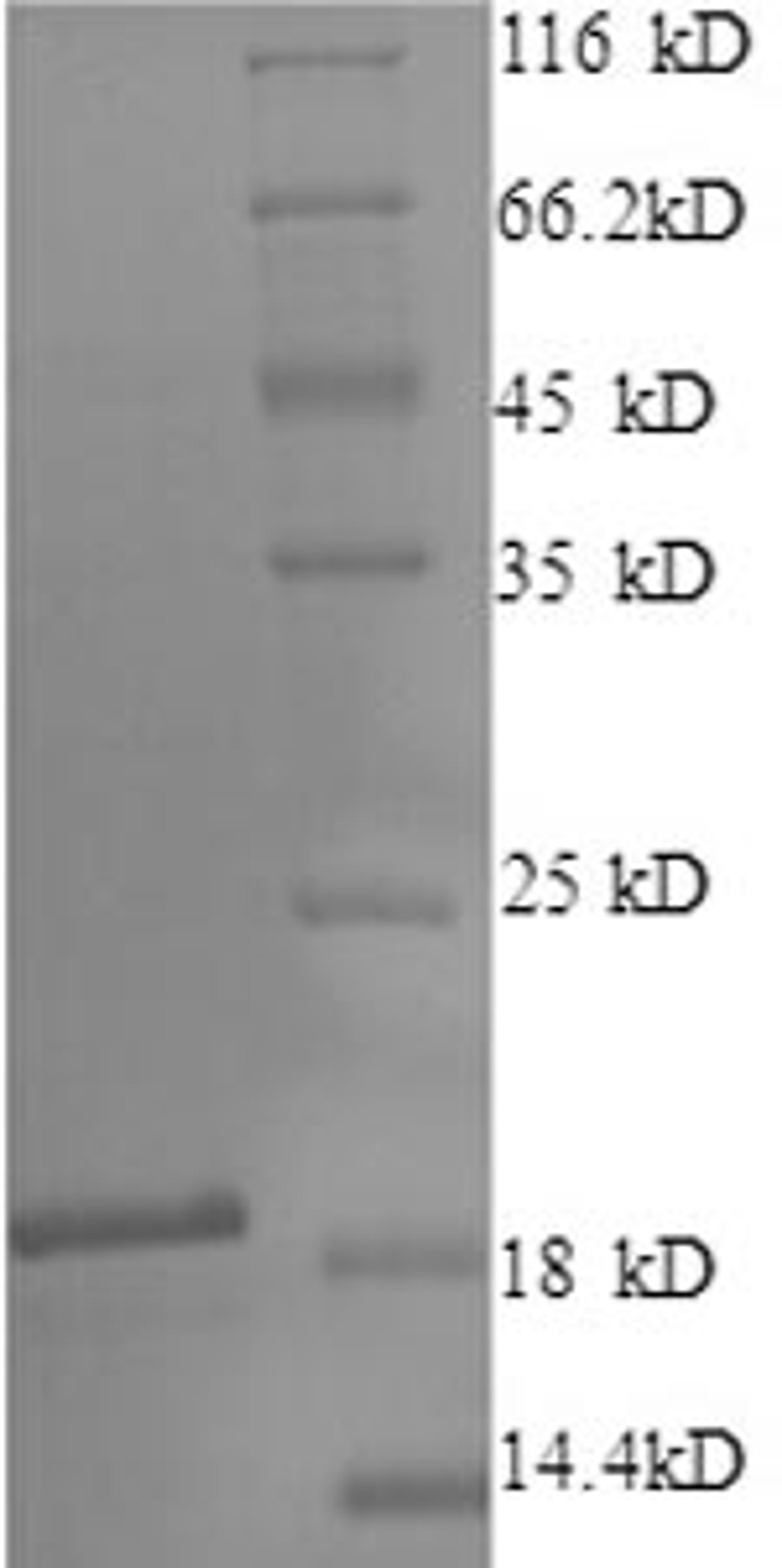 (Tris-Glycine gel) Discontinuous SDS-PAGE (reduced) with 5% enrichment gel and 15% separation gel.