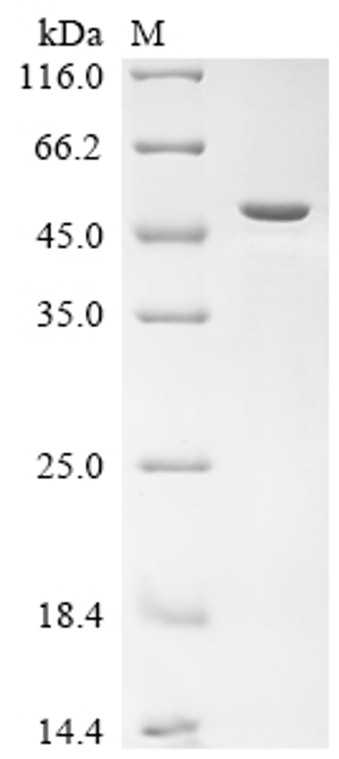 (Tris-Glycine gel) Discontinuous SDS-PAGE (reduced) with 5% enrichment gel and 15% separation gel.