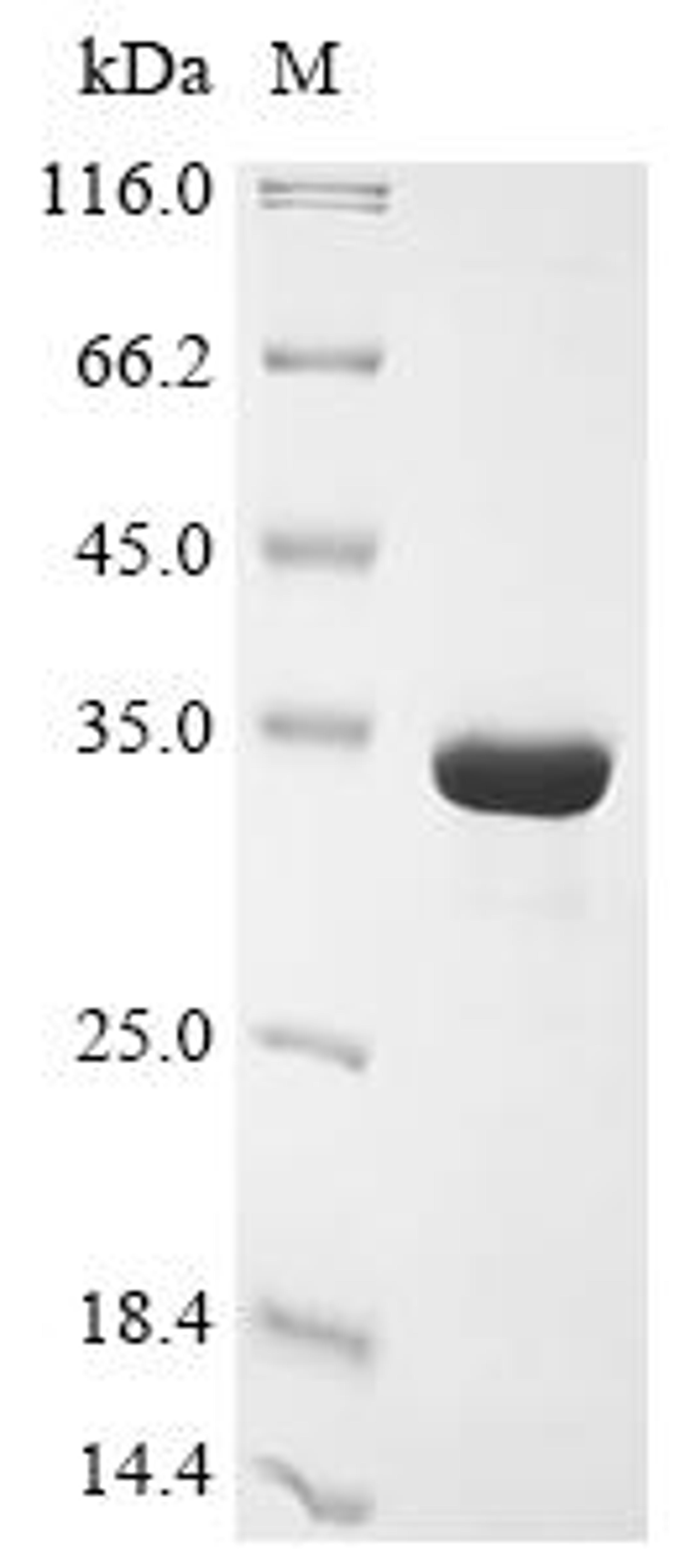 (Tris-Glycine gel) Discontinuous SDS-PAGE (reduced) with 5% enrichment gel and 15% separation gel.