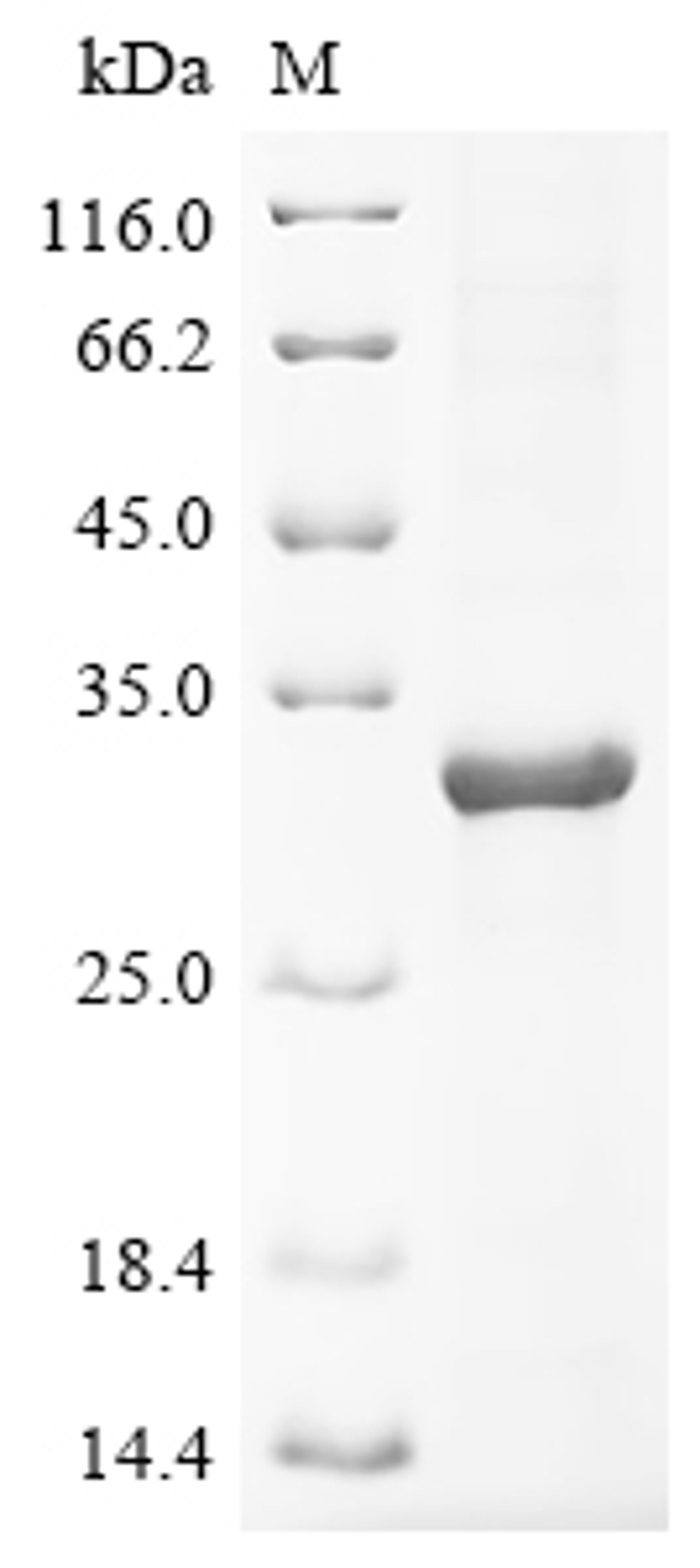 (Tris-Glycine gel) Discontinuous SDS-PAGE (reduced) with 5% enrichment gel and 15% separation gel.
