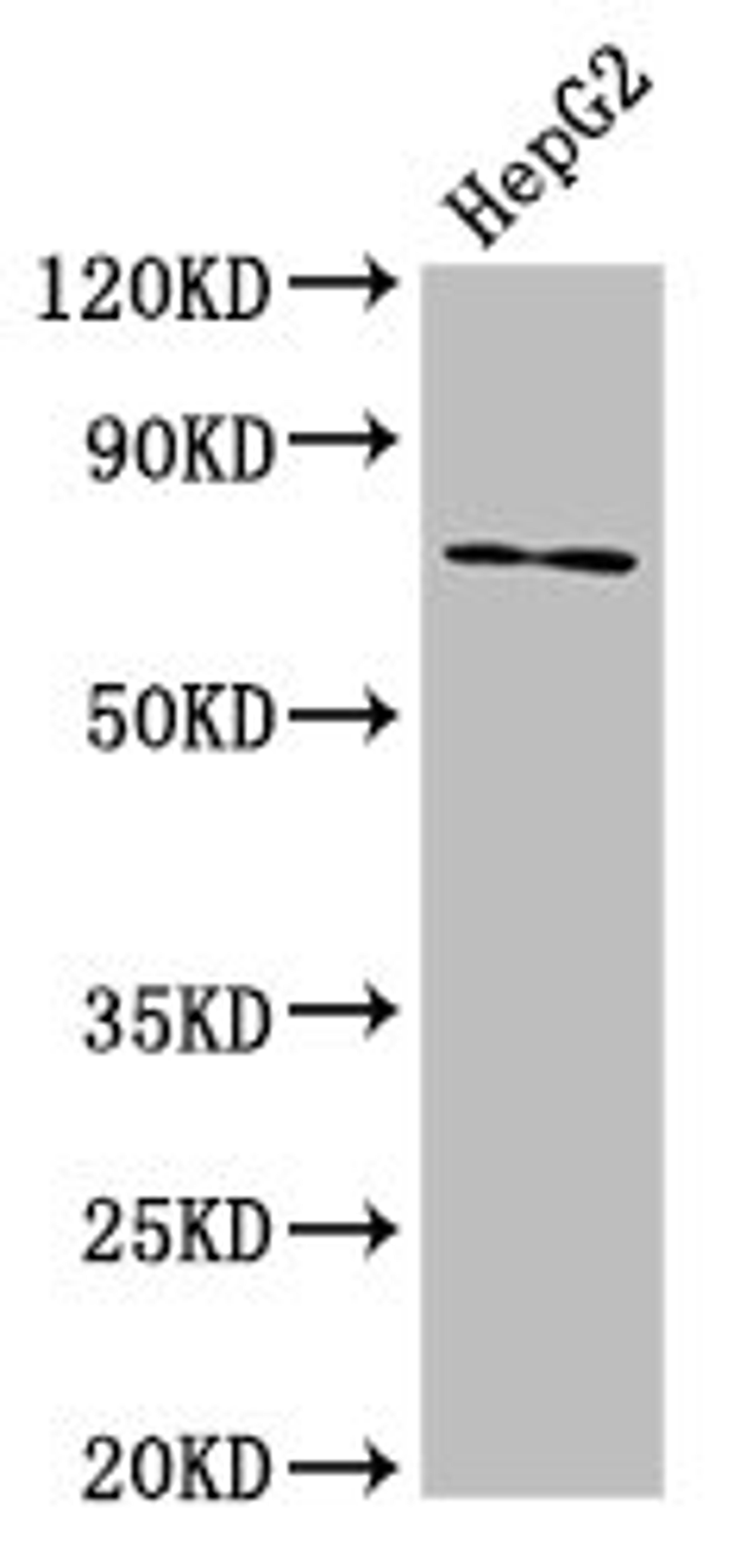Western Blot. Positive WB detected in: HepG2 whole cell lysate. All lanes: ABCG5 antibody at 8.7µg/ml. Secondary. Goat polyclonal to rabbit IgG at 1/50000 dilution. Predicted band size: 73, 29 kDa. Observed band size: 73 kDa