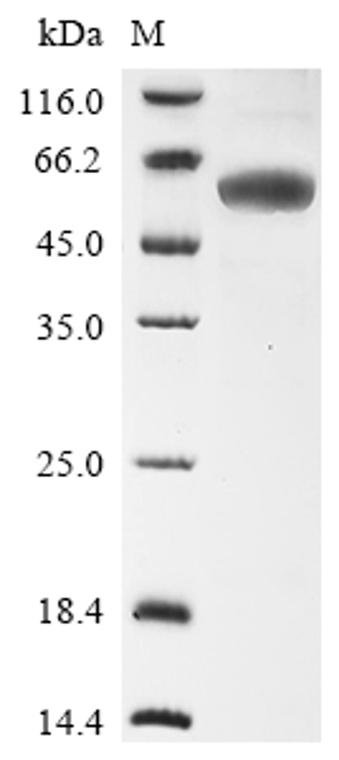 (Tris-Glycine gel) Discontinuous SDS-PAGE (reduced) with 5% enrichment gel and 15% separation gel.