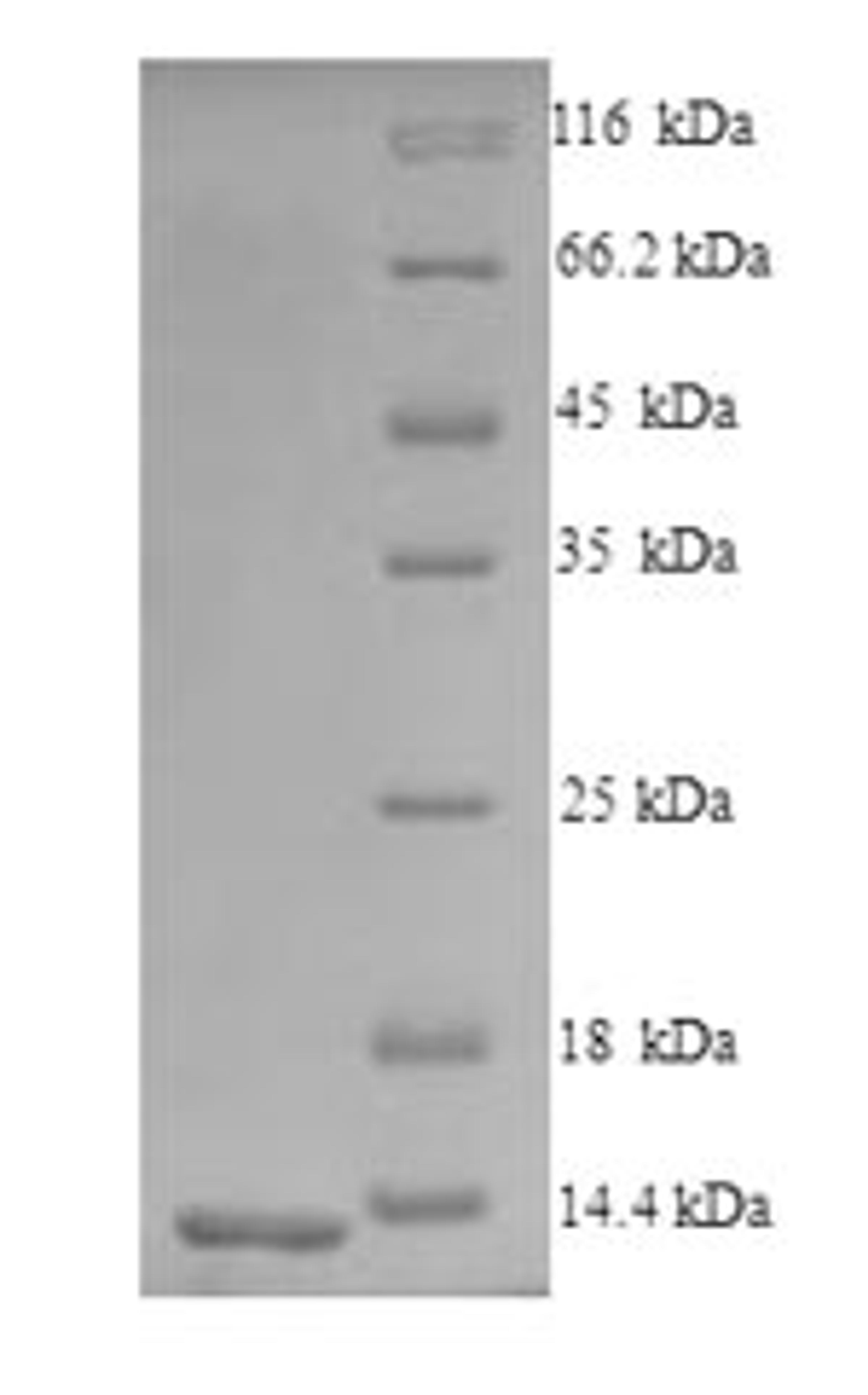 (Tris-Glycine gel) Discontinuous SDS-PAGE (reduced) with 5% enrichment gel and 15% separation gel.