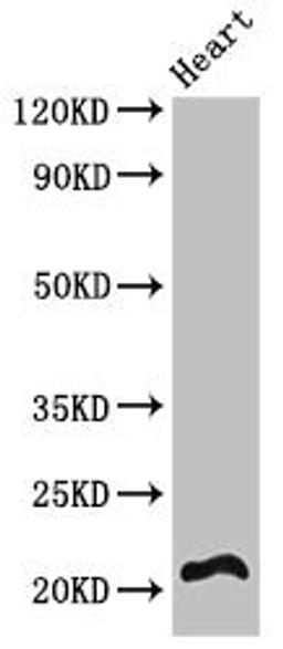 Western Blot. Positive WB detected in: Mouse heart tissue. All lanes: RCAN2 antibody at 3ug/ml. Secondary. Goat polyclonal to rabbit IgG at 1/50000 dilution. Predicted band size: 22, 28 kDa. Observed band size: 22 kDa. 