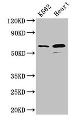 Western Blot. Positive WB detected in: K562 whole cell lysate, Mouse heart tissue. All lanes: ATP5F1A antibody at 2.5ug/ml. Secondary. Goat polyclonal to rabbit IgG at 1/50000 dilution. Predicted band size: 60, 55, 58 kDa. Observed band size: 60 kDa.