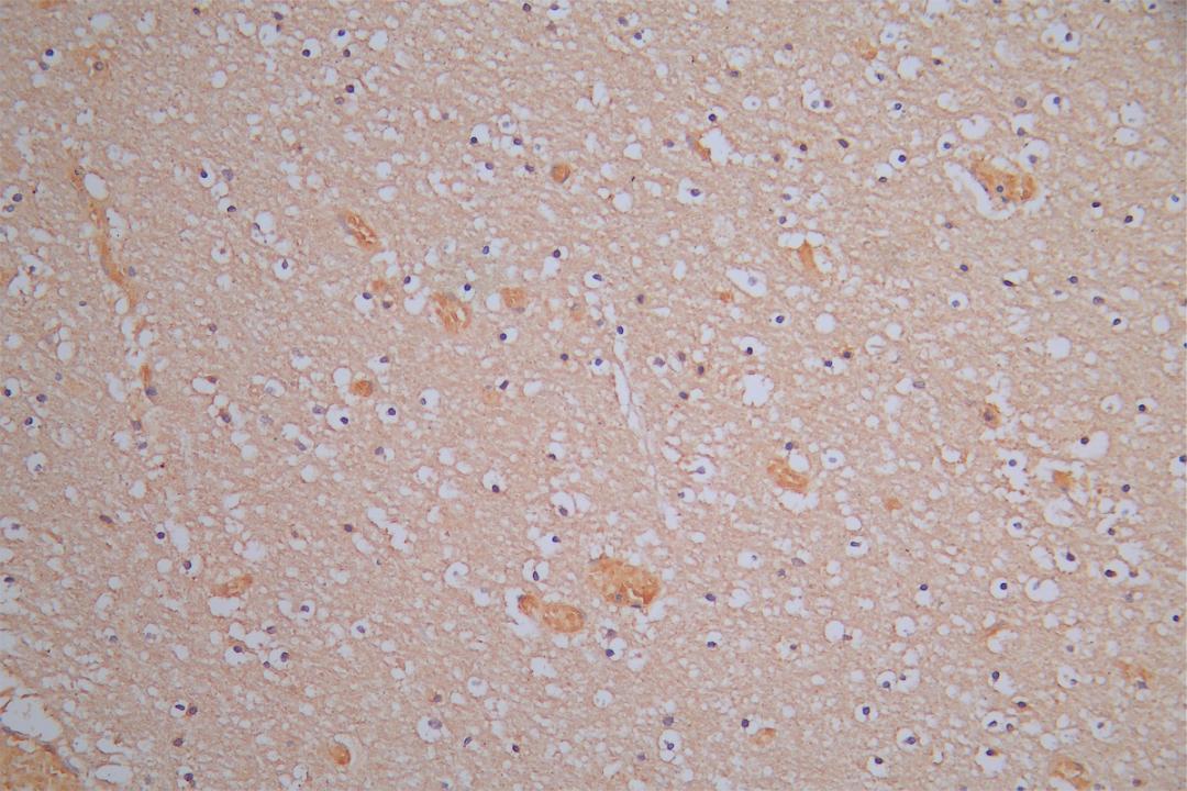IHC image of CSB-RA614975MA1HU diluted at 1:150 and staining in paraffin-embedded human brain tissue performed on a Leica BondTM system. After dewaxing and hydration, antigen retrieval was mediated by high pressure in a citrate buffer (pH 6.0). Section was blocked with 10% normal goat serum 30min at RT. Then primary antibody (1% BSA) was incubated at 4°C overnight. The primary is detected by a Goat anti-Rabbit IgG labeled by HRP and visualized using 0.05% DAB.