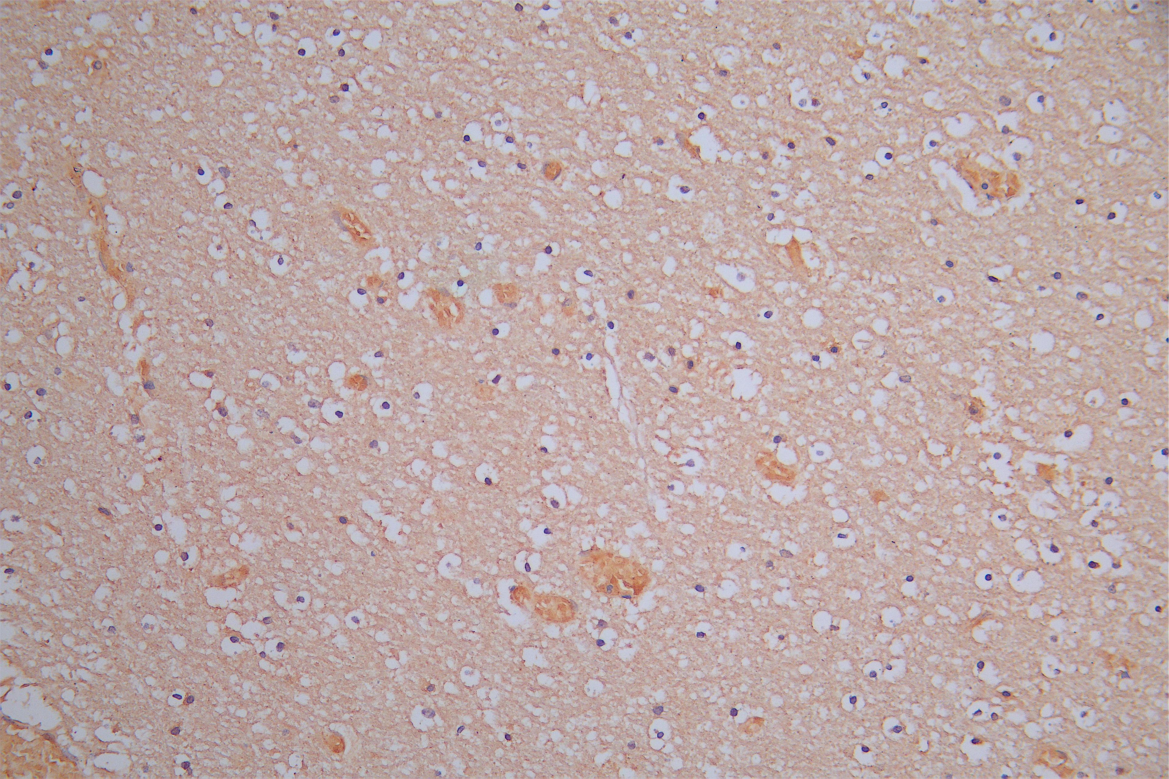 IHC image of CSB-RA614975MA1HU diluted at 1:150 and staining in paraffin-embedded human brain tissue performed on a Leica BondTM system. After dewaxing and hydration, antigen retrieval was mediated by high pressure in a citrate buffer (pH 6.0). Section was blocked with 10% normal goat serum 30min at RT. Then primary antibody (1% BSA) was incubated at 4°C overnight. The primary is detected by a Goat anti-Rabbit IgG labeled by HRP and visualized using 0.05% DAB.
