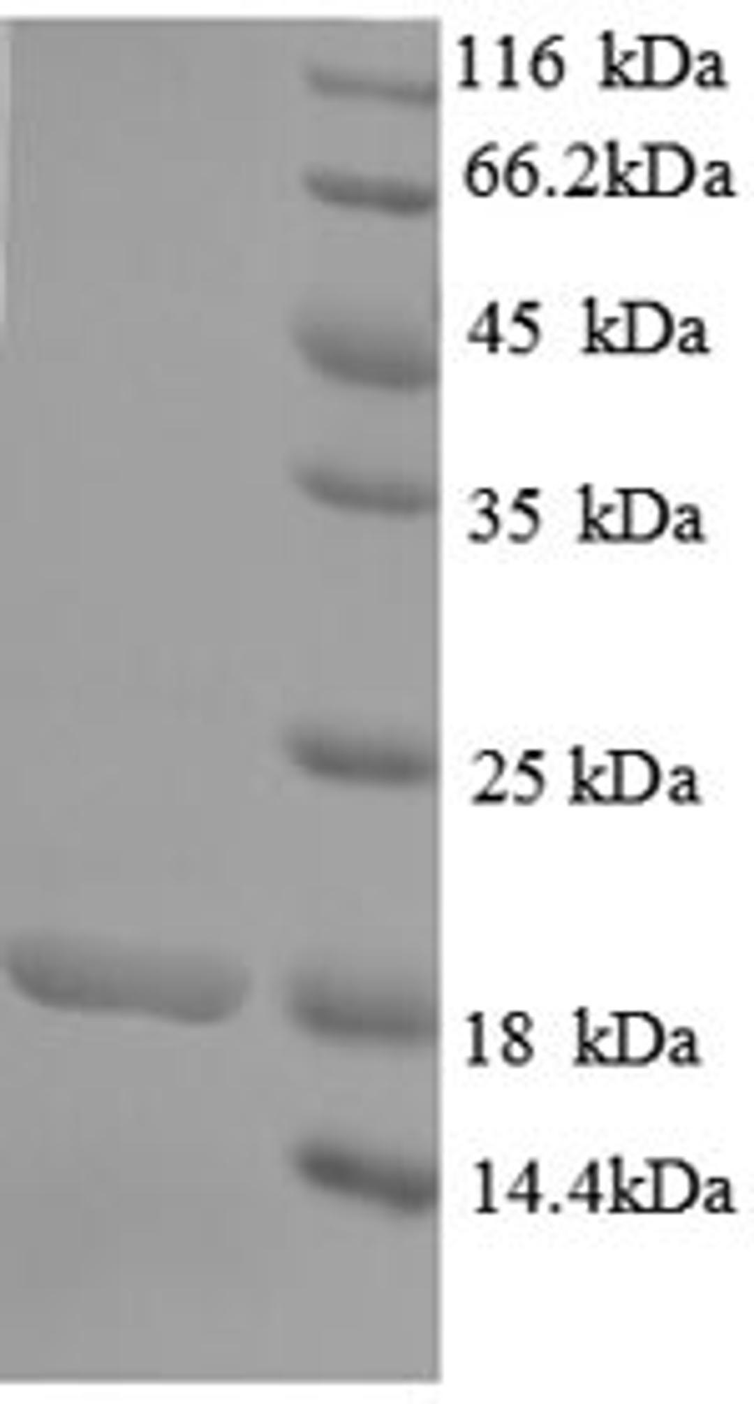 (Tris-Glycine gel) Discontinuous SDS-PAGE (reduced) with 5% enrichment gel and 15% separation gel.
