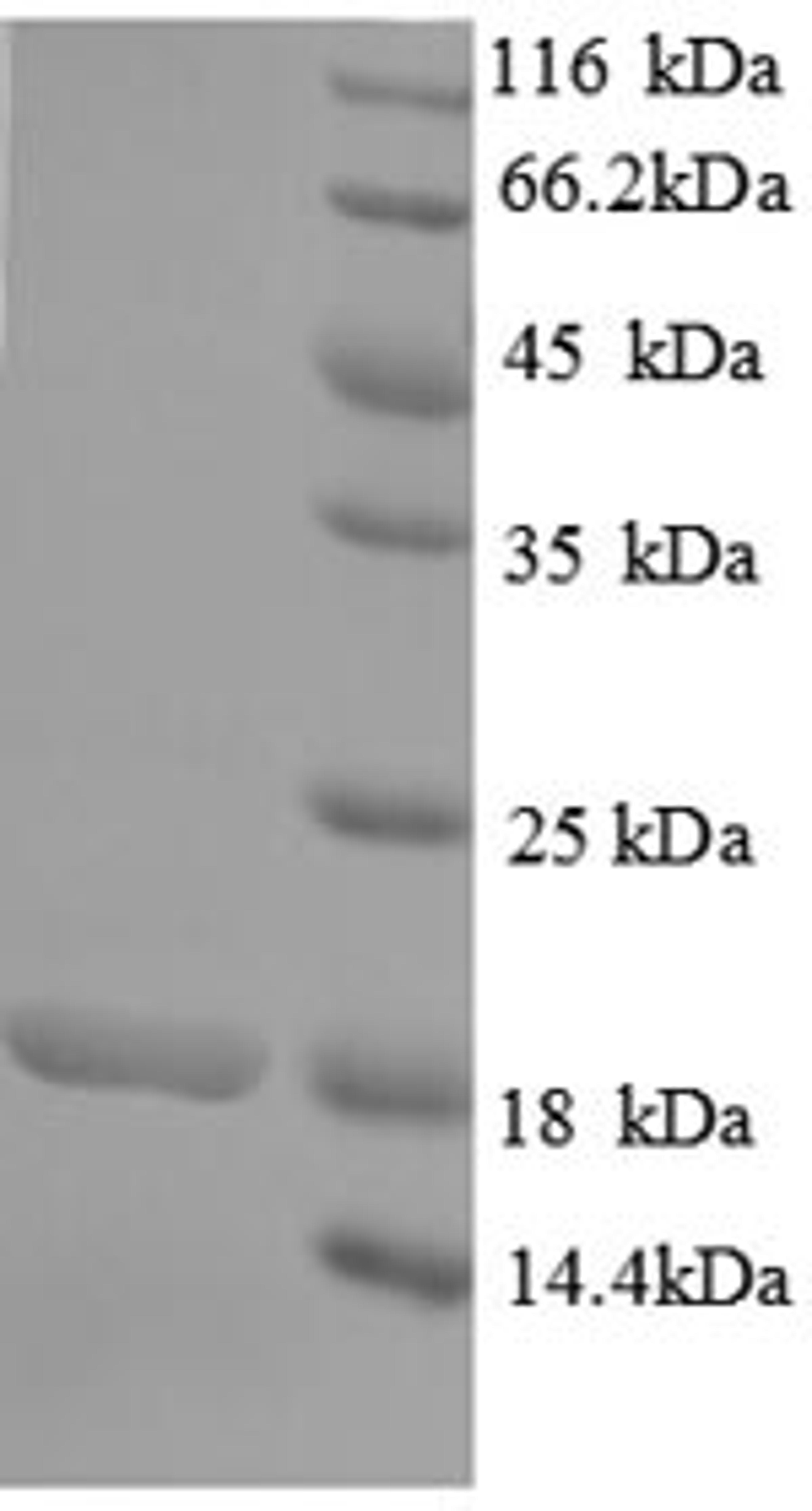 (Tris-Glycine gel) Discontinuous SDS-PAGE (reduced) with 5% enrichment gel and 15% separation gel.