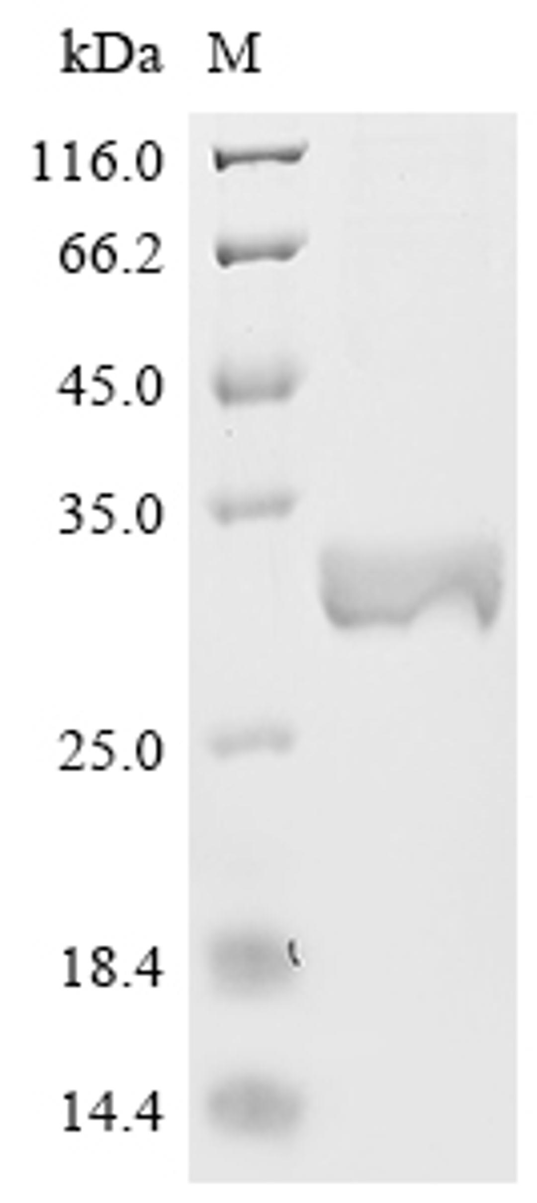 (Tris-Glycine gel) Discontinuous SDS-PAGE (reduced) with 5% enrichment gel and 15% separation gel.