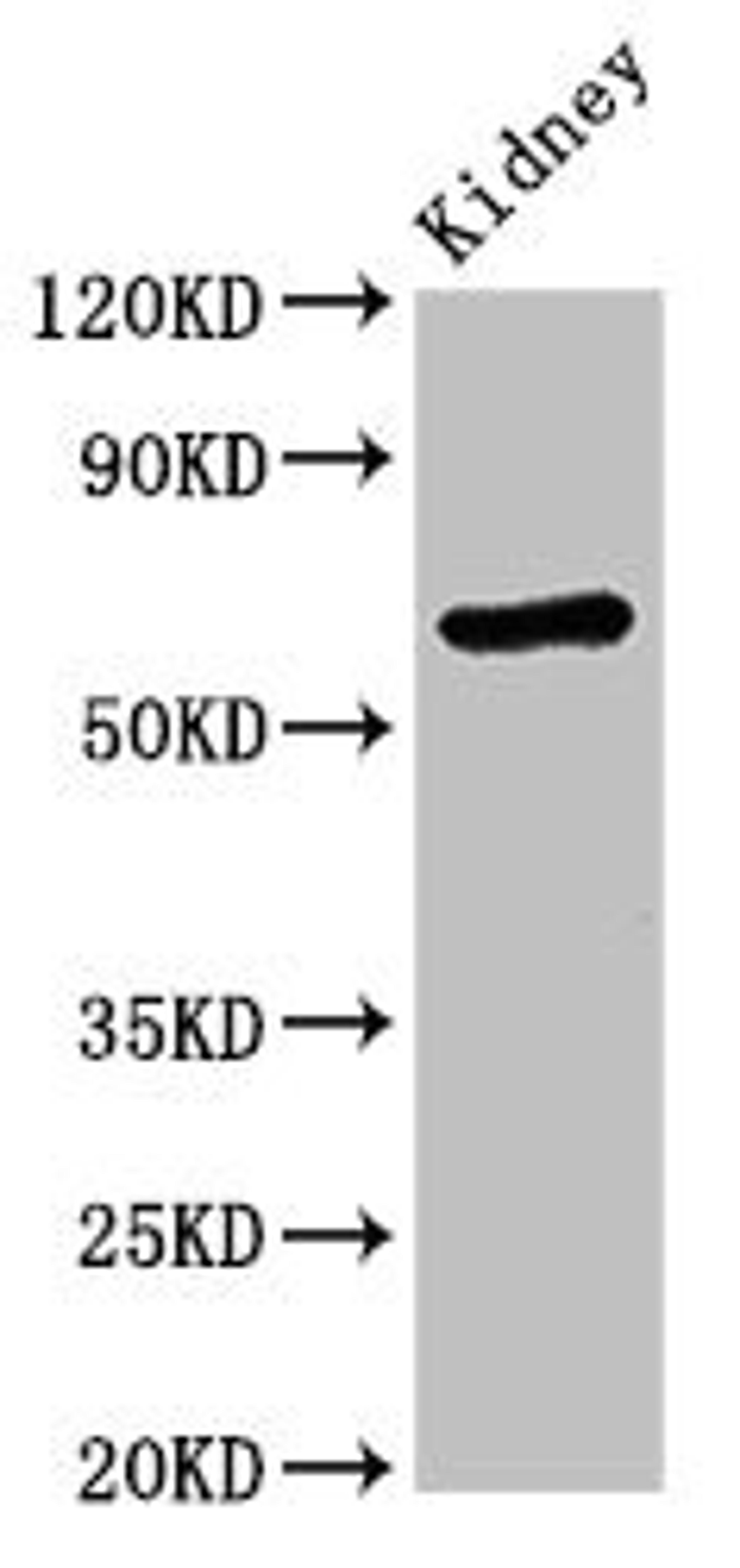Western Blot. Positive WB detected in: Mouse kidney tissue. All lanes: STXBP3 antibody at 3.4ug/ml. Secondary. Goat polyclonal to rabbit IgG at 1/50000 dilution. Predicted band size: 68 kDa. Observed band size: 68 kDa. 