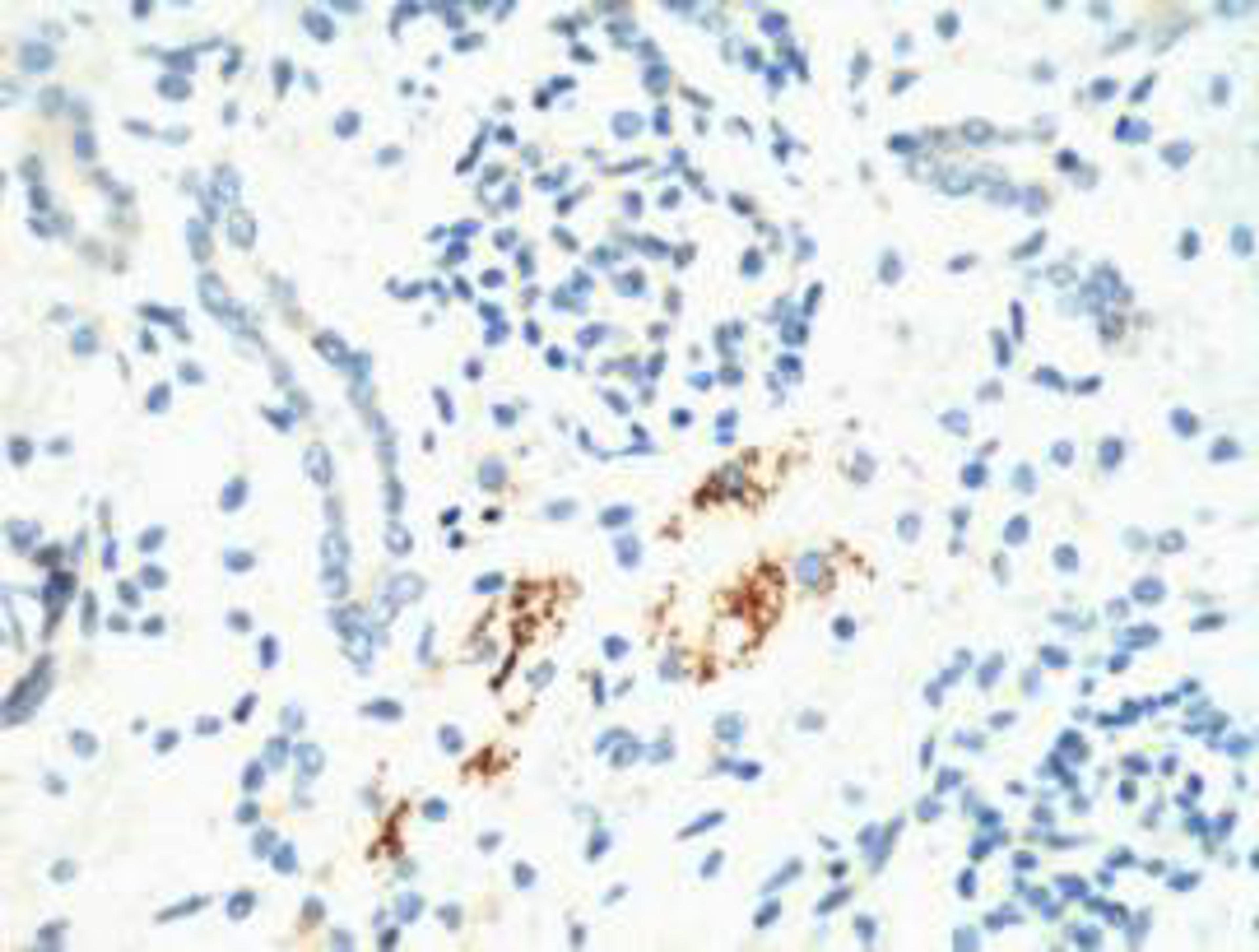 IHC staining of Mouse Kidney tissue, diluted at 1:200.
