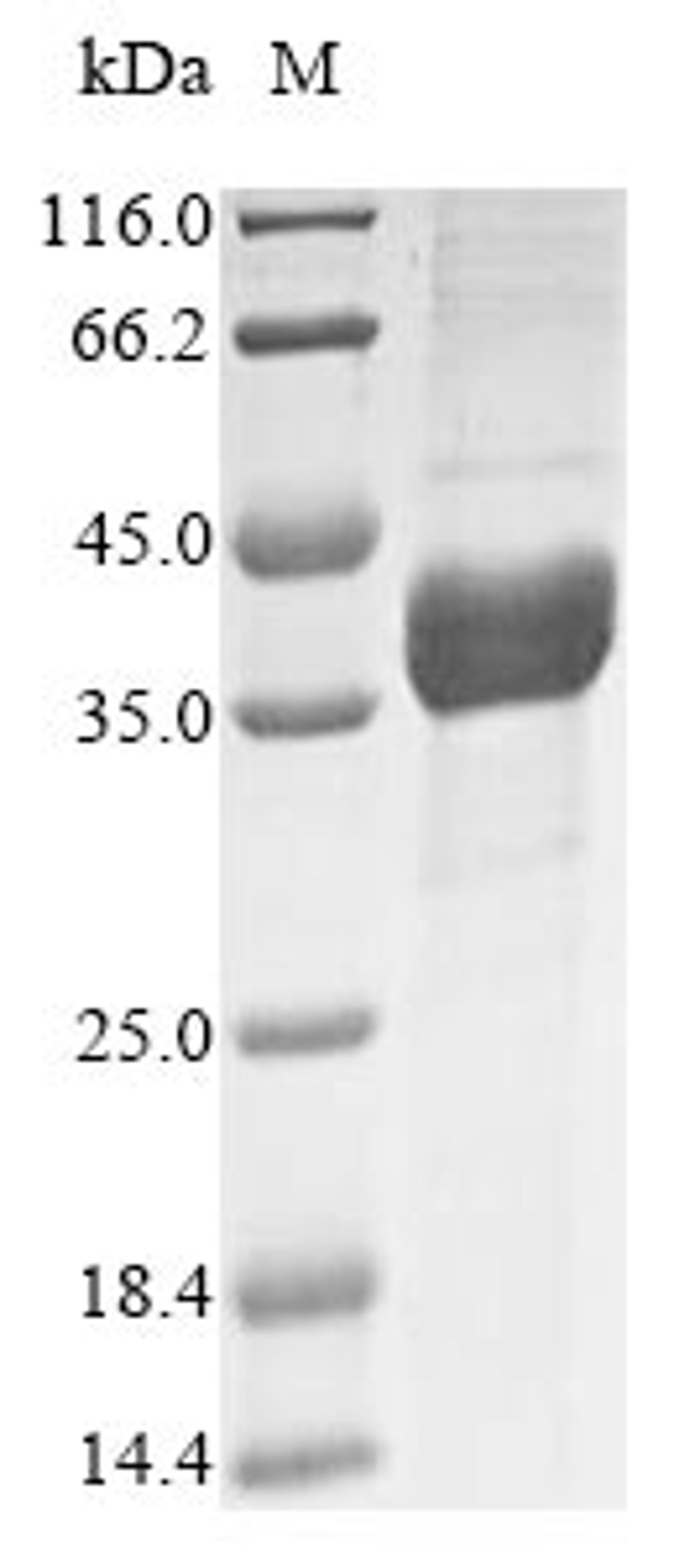 (Tris-Glycine gel) Discontinuous SDS-PAGE (reduced) with 5% enrichment gel and 15% separation gel.