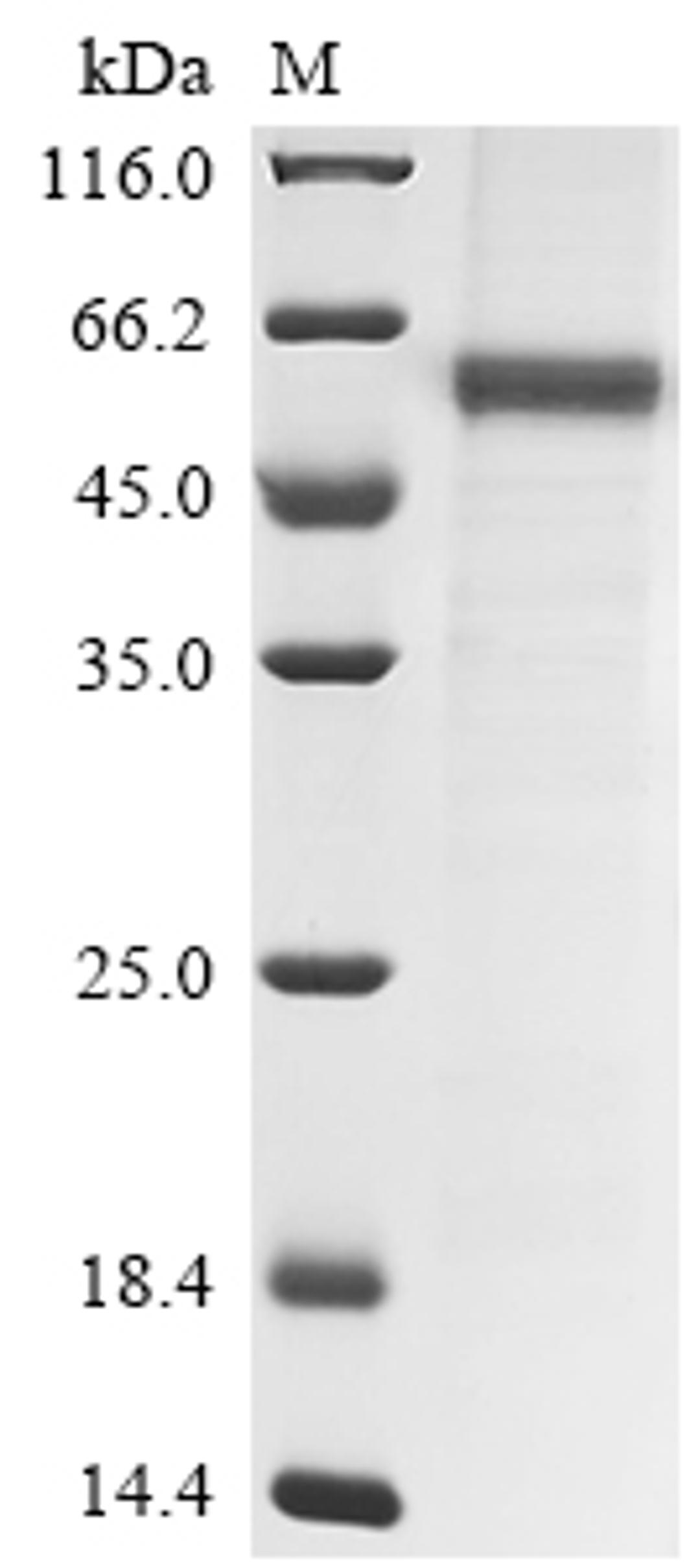 (Tris-Glycine gel) Discontinuous SDS-PAGE (reduced) with 5% enrichment gel and 15% separation gel.