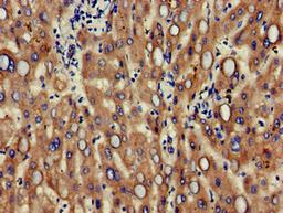 Immunohistochemistry of paraffin-embedded human liver tissue using CSB-PA10209A0Rb at dilution of 1:100